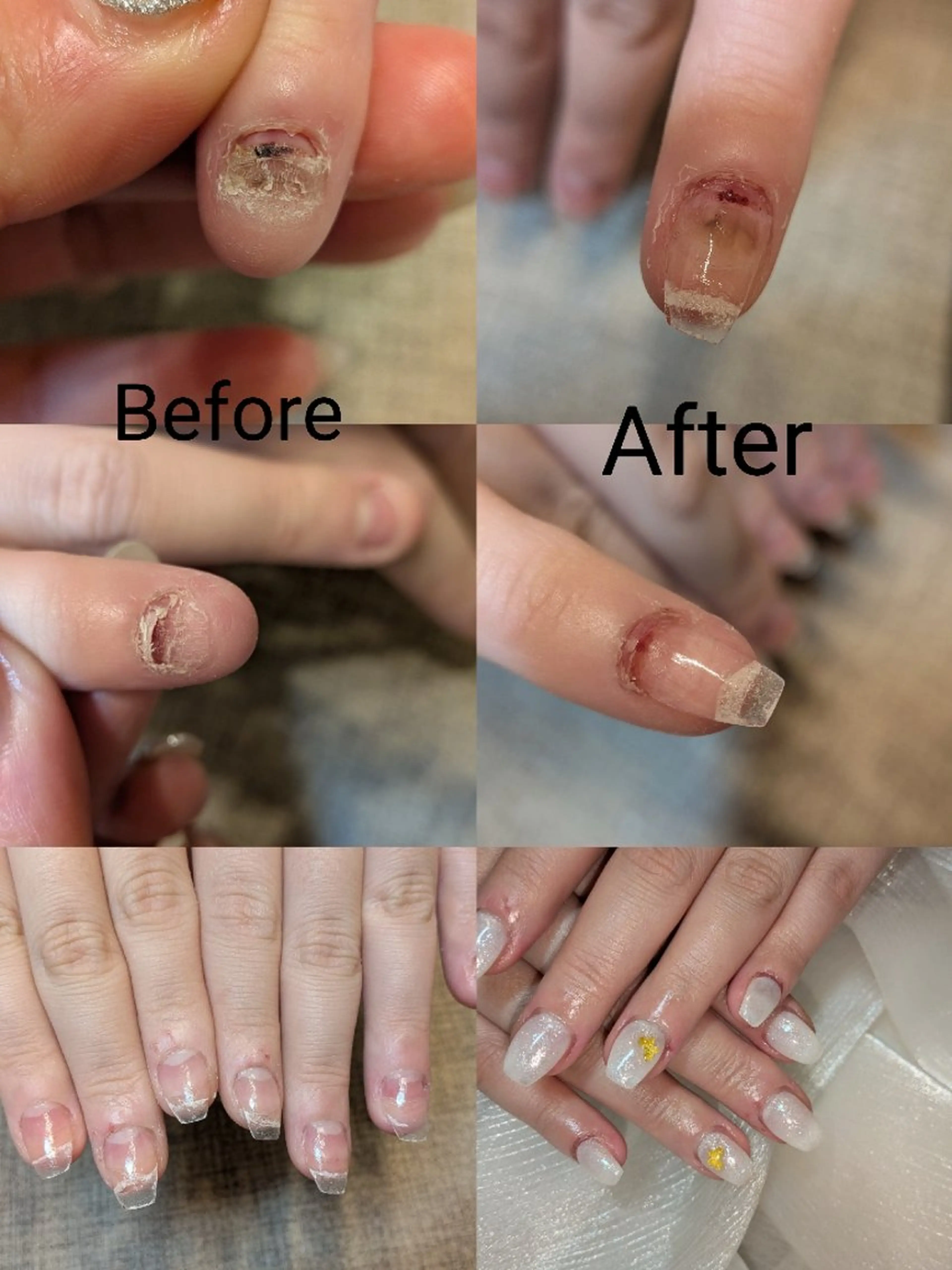 ネイル ハンドネイル ハンドケア フィルイン・深爪矯正 長さ出し・リラク

のネイルデザイン