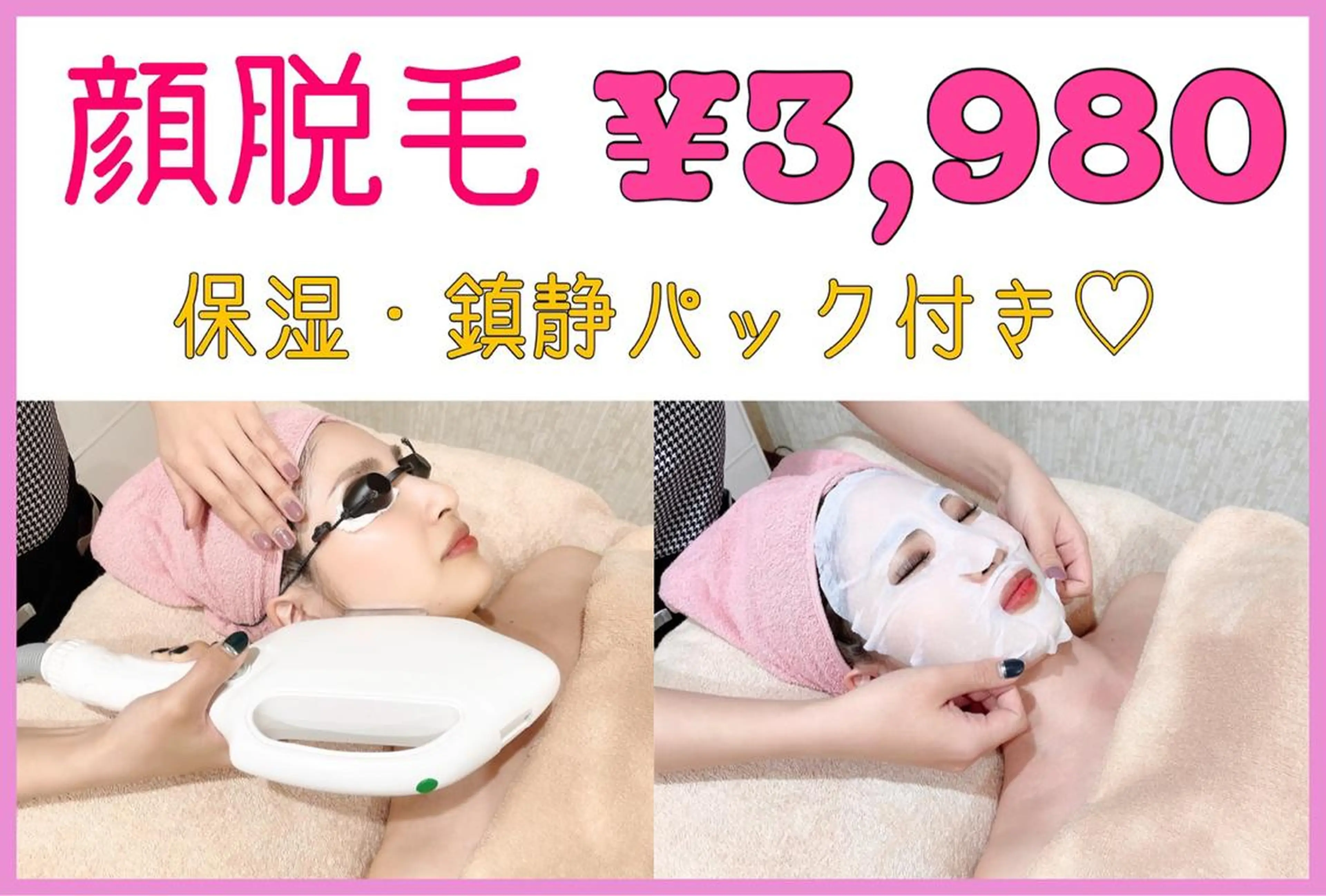 【女性！何度でもOK！】顔脱毛+パック付き！生毛をなくして化粧ノリUP¥3980→¥3500の写真