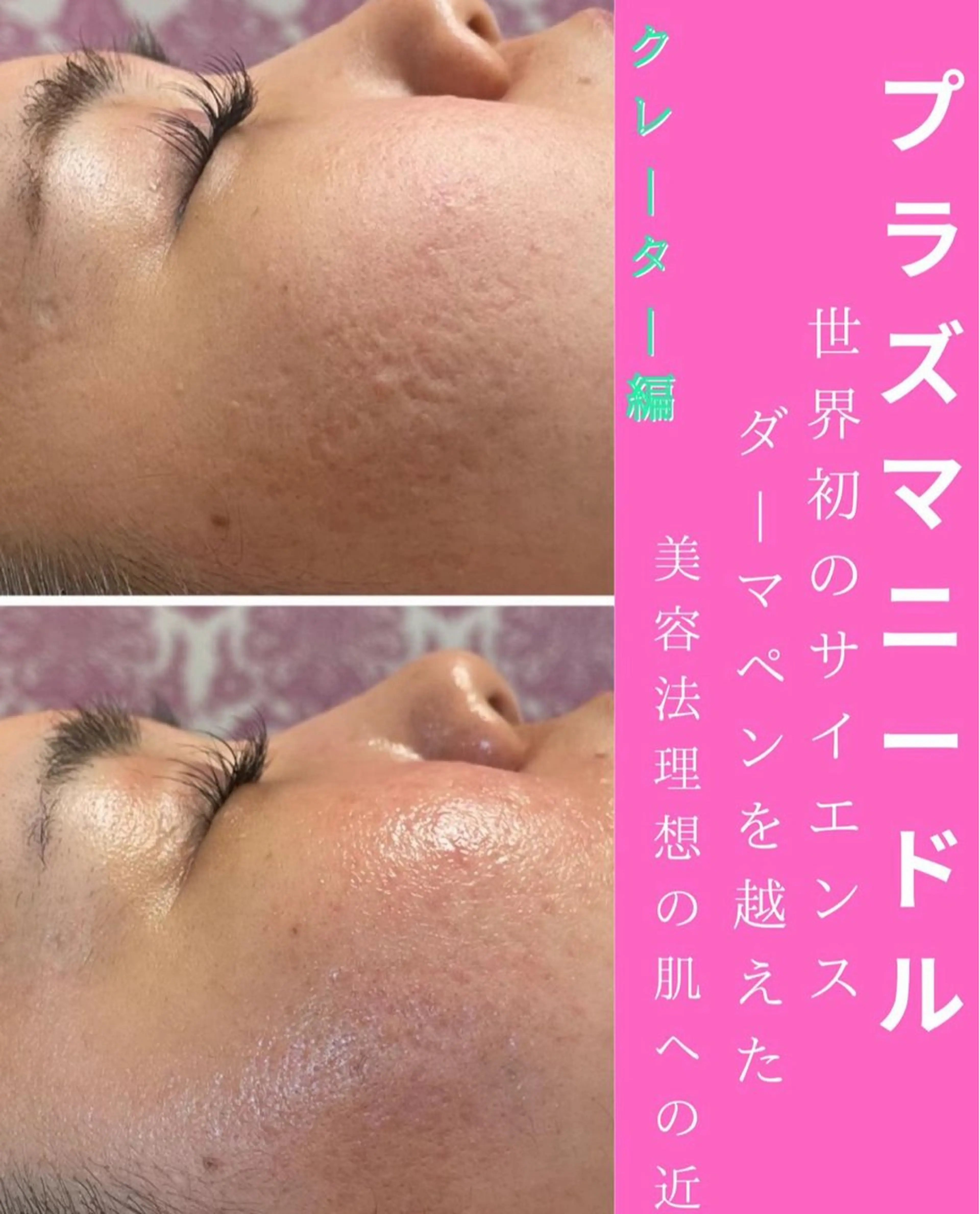 WAX・肌質改善・毛 穴洗浄/林愛真のエステ・リラクイメージ