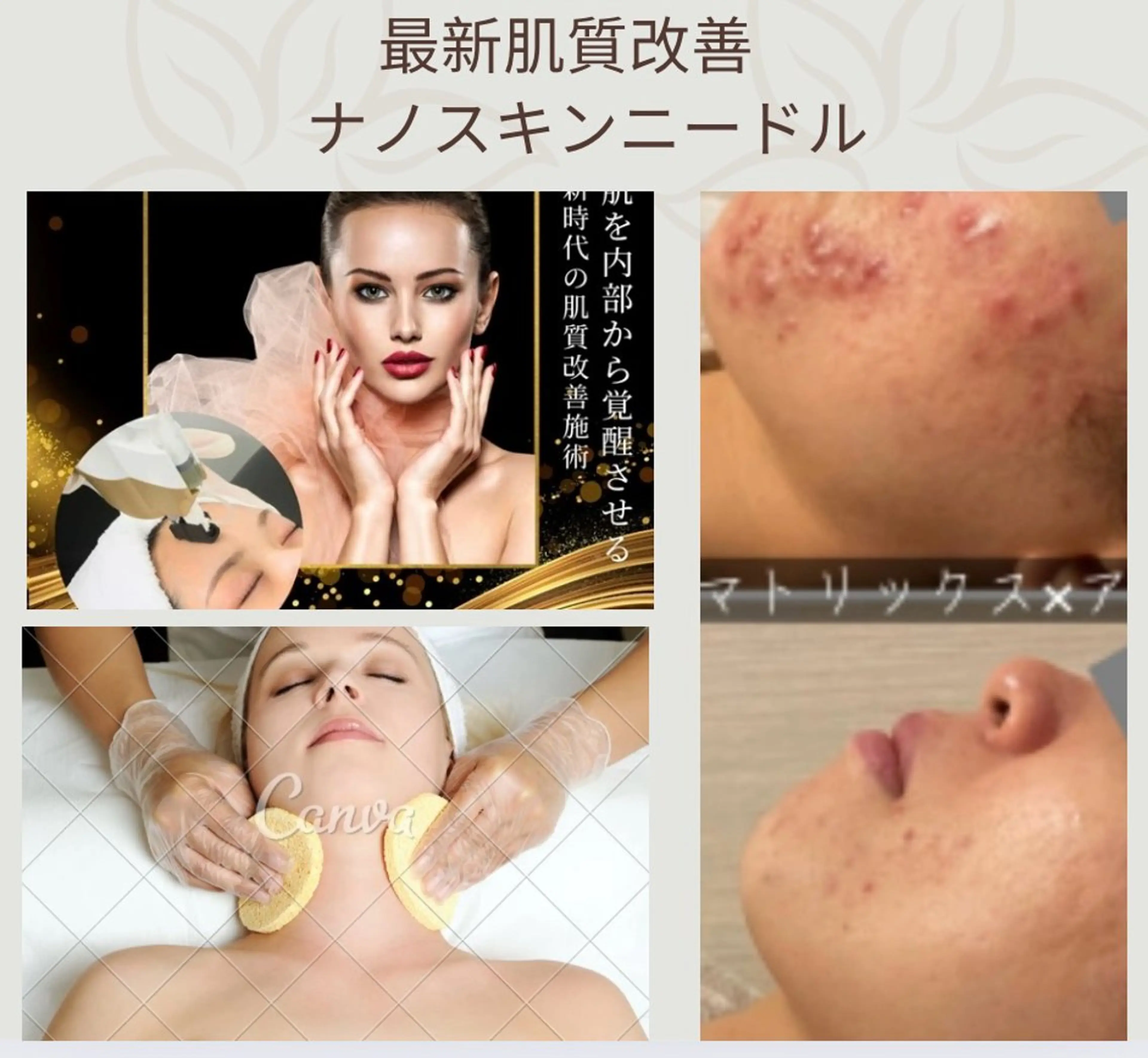 最新肌質改善【ニキビケア】 毛穴洗浄+ニキビアンプル導入+美容成分導入の写真