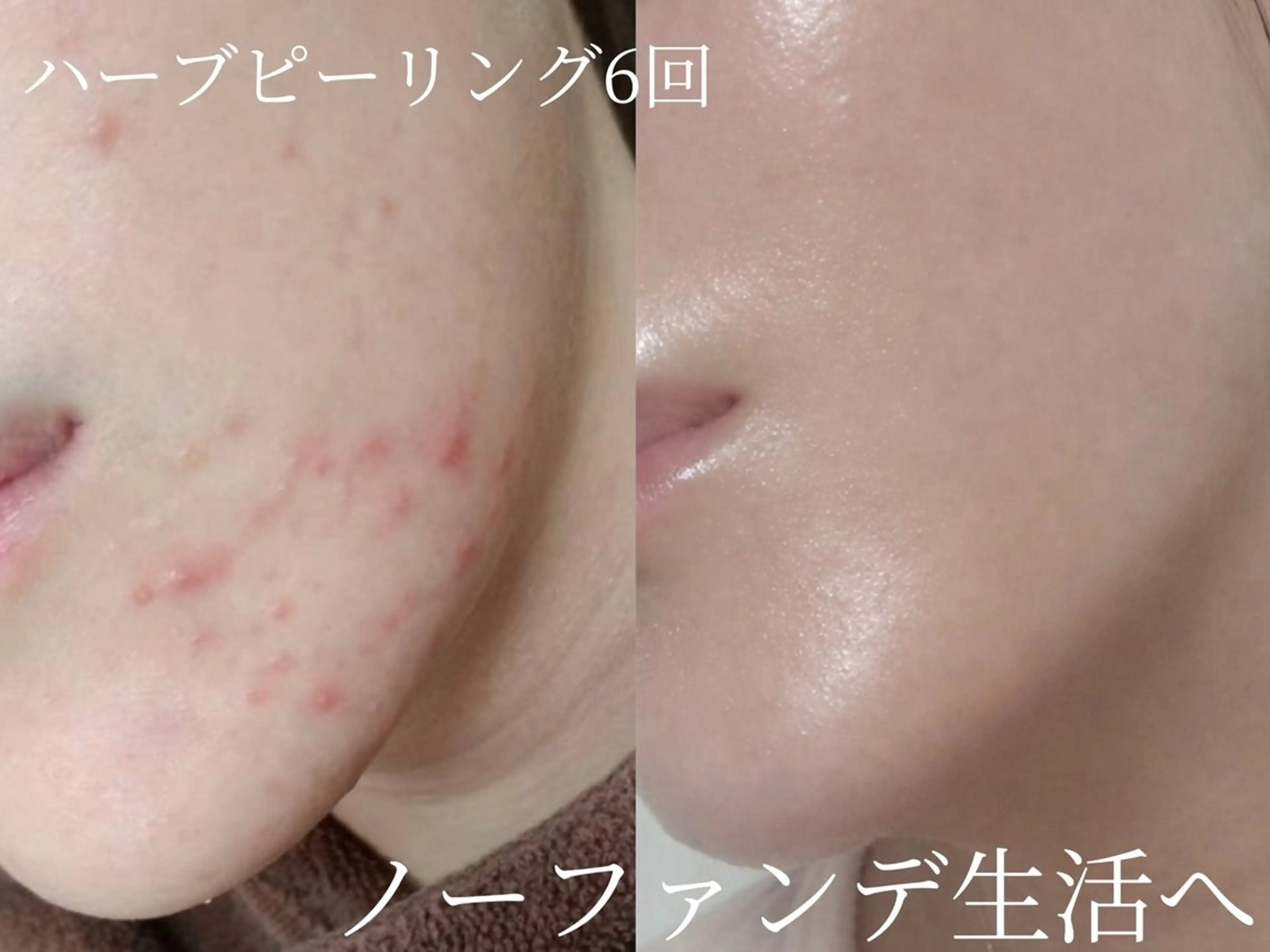 艶肌デトックス🫧 Samiraのエステ・リラクイメージ