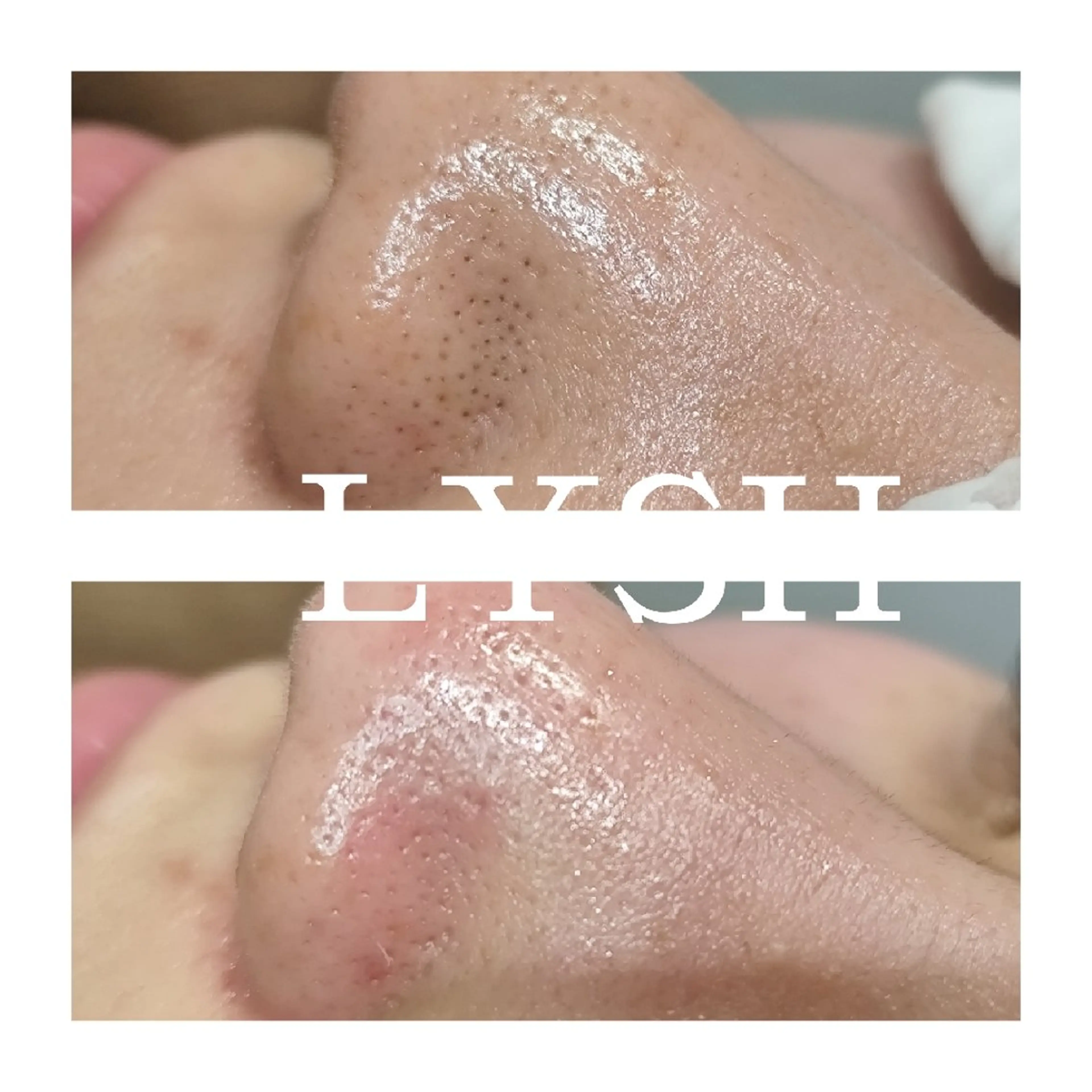 エステサロン LYSHのその他イメージ