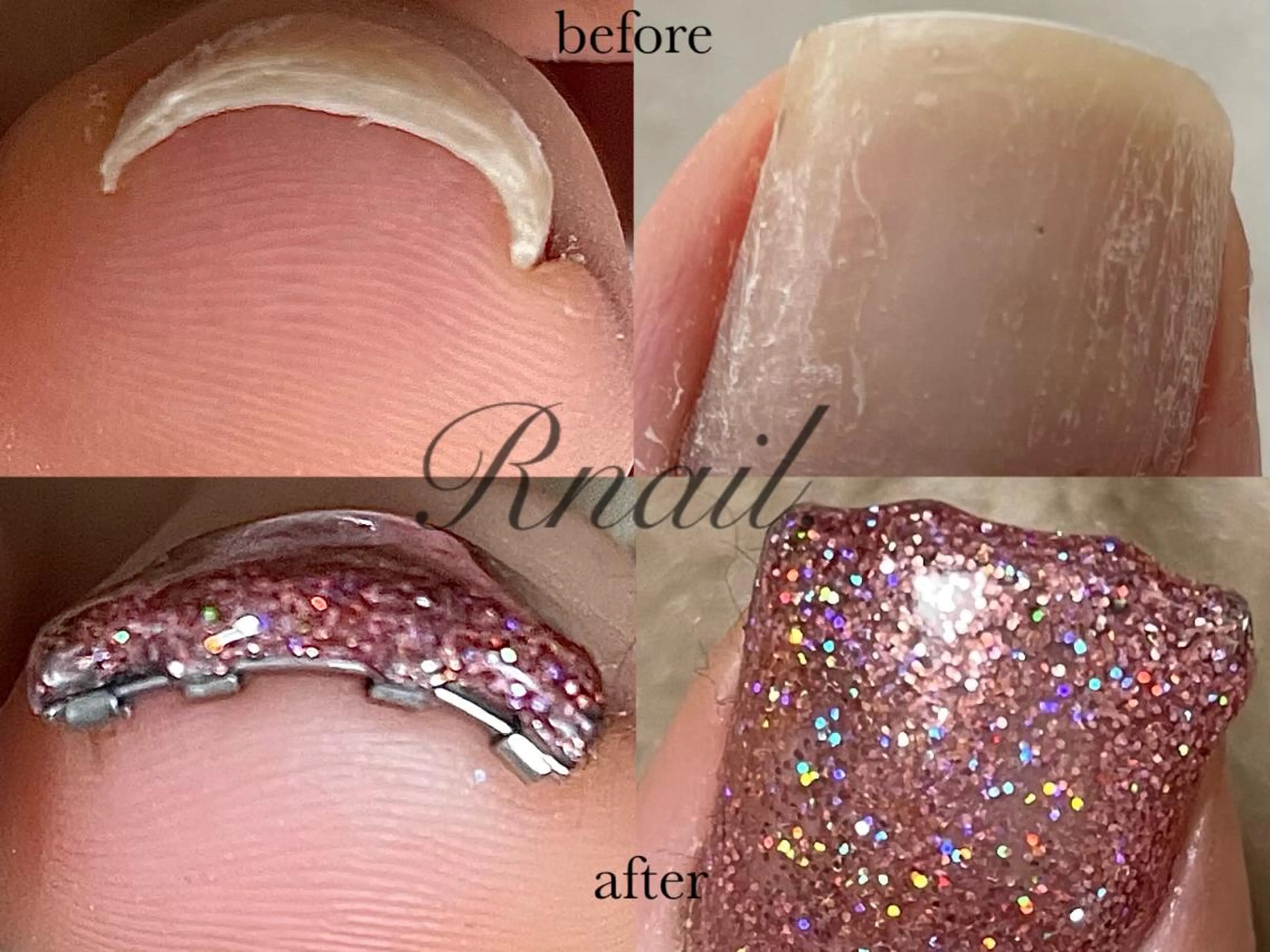 ネイル ジェルネイル フットネイル R nail.のネイルデザイン