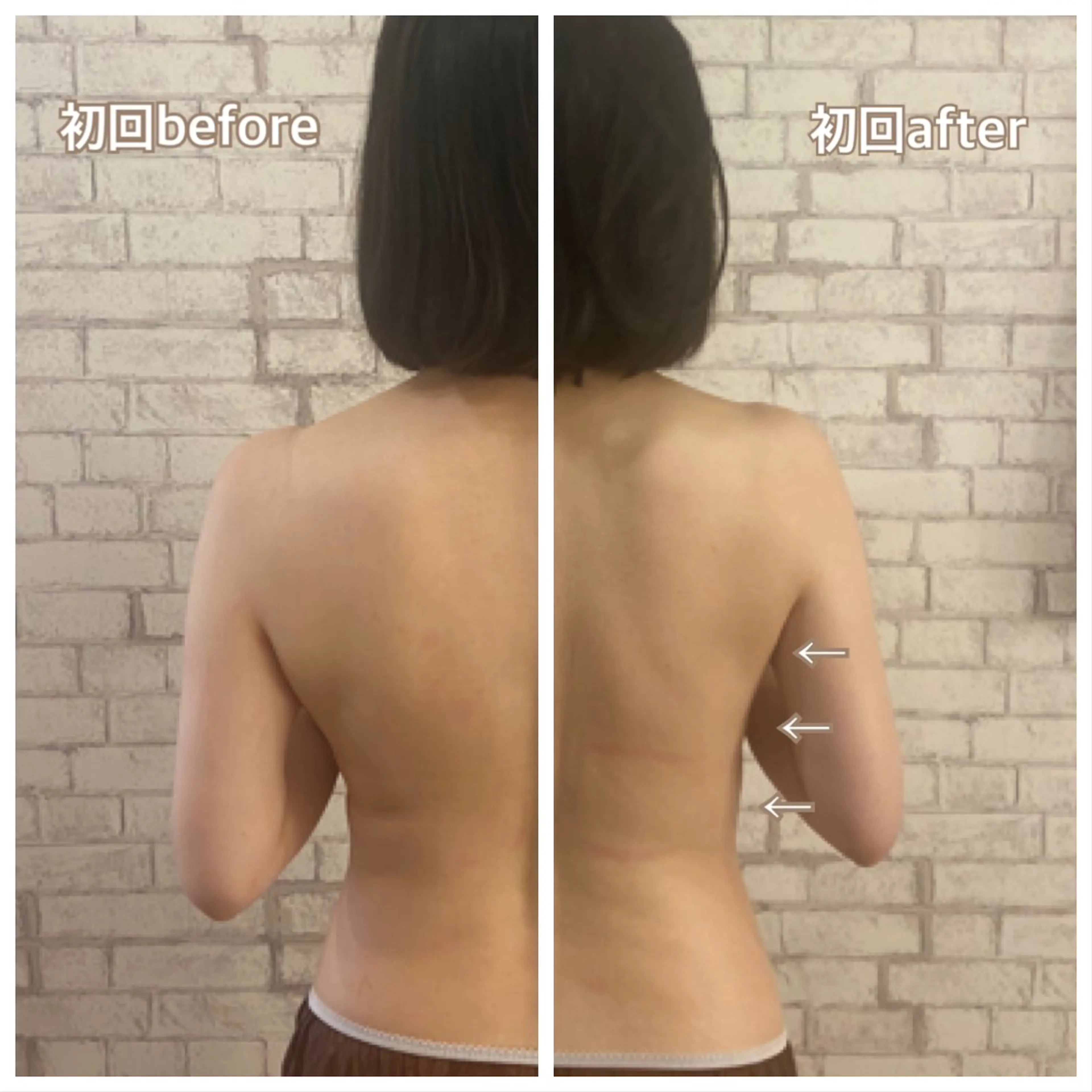 【小顔矯正】 salonaceのエステ・リラクイメージ