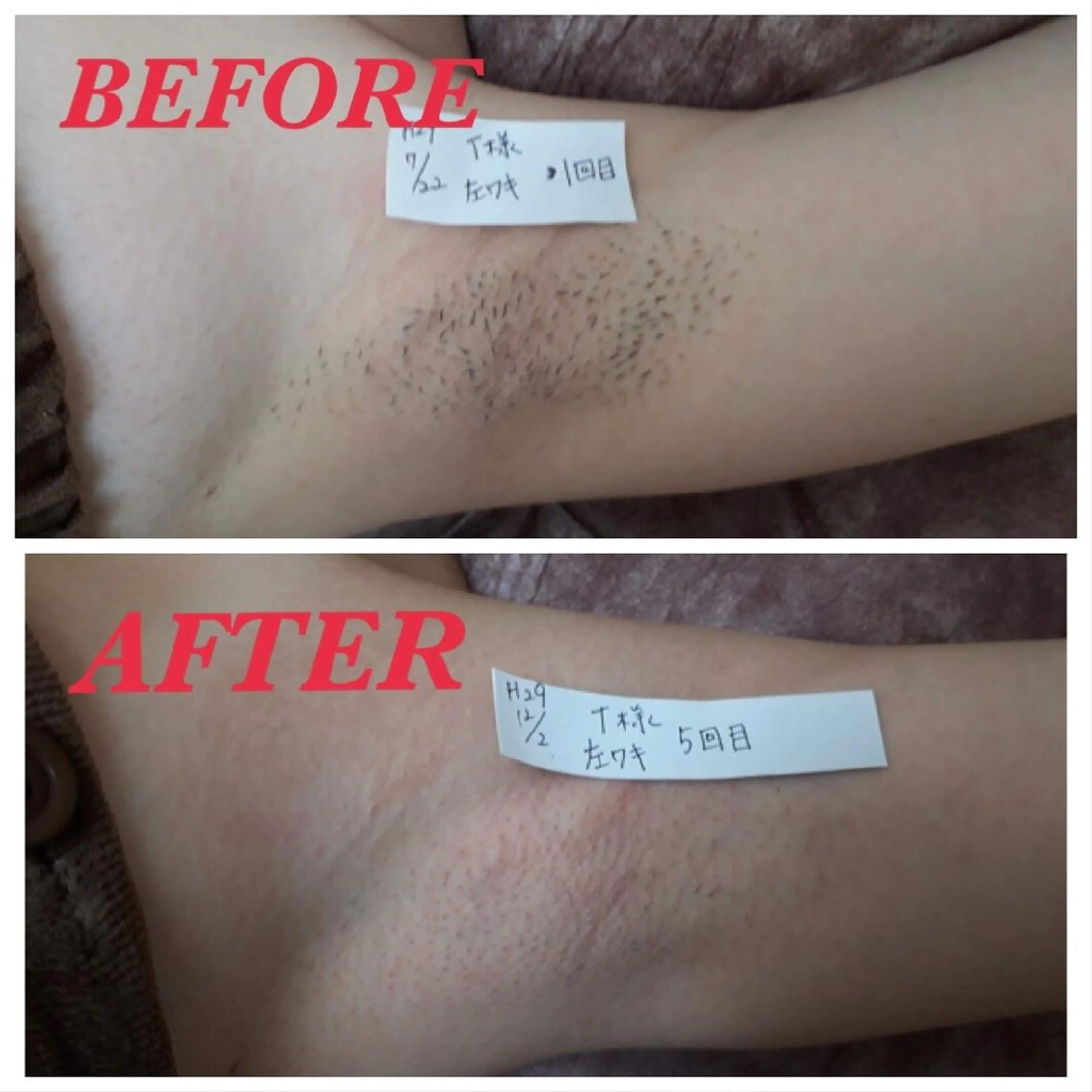 脱毛 Prima（プリマ） 名古屋駅本店のエステ・リラクイメージ