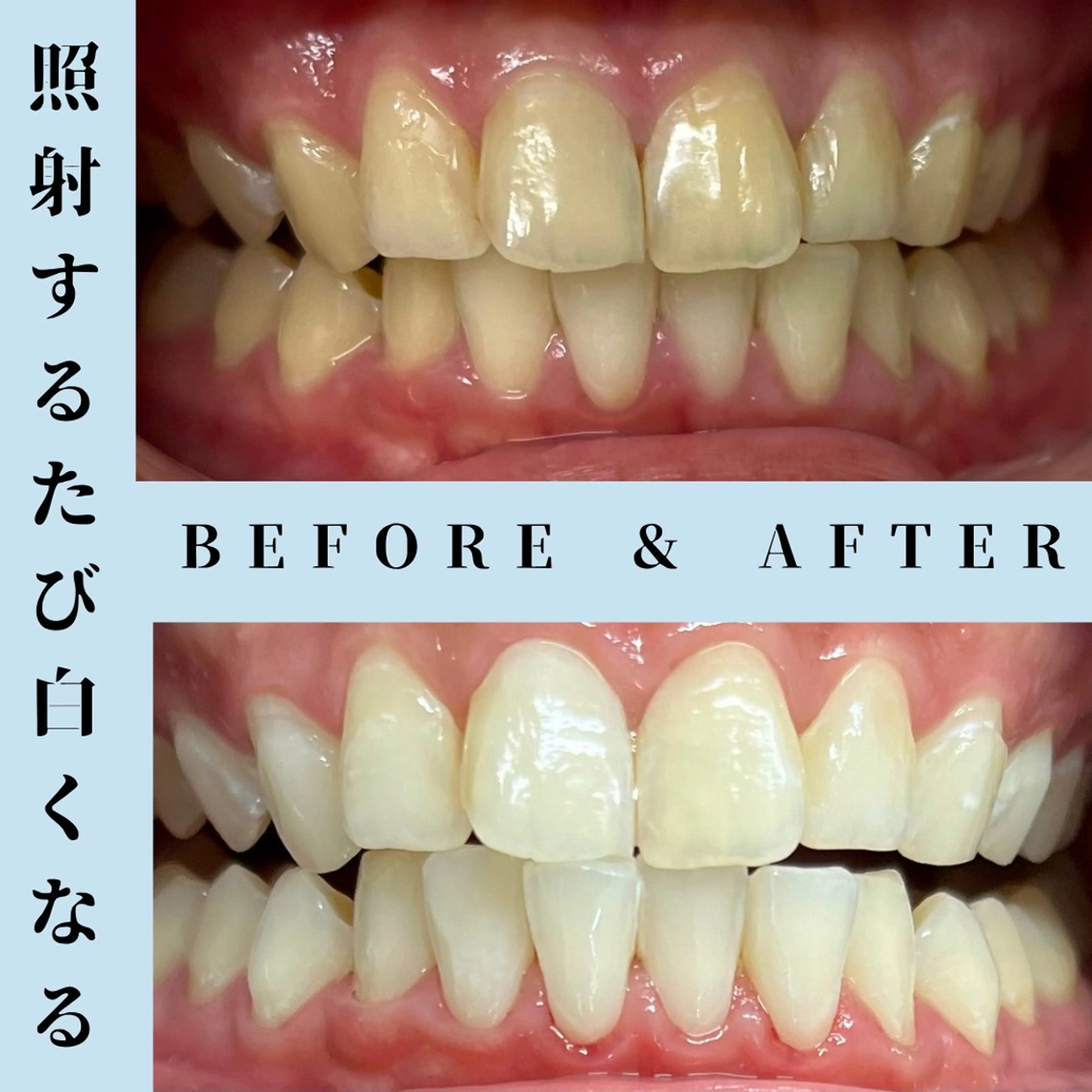 メンズ その他 セルフホワイトニング Dolce水戸店のその他イメージ