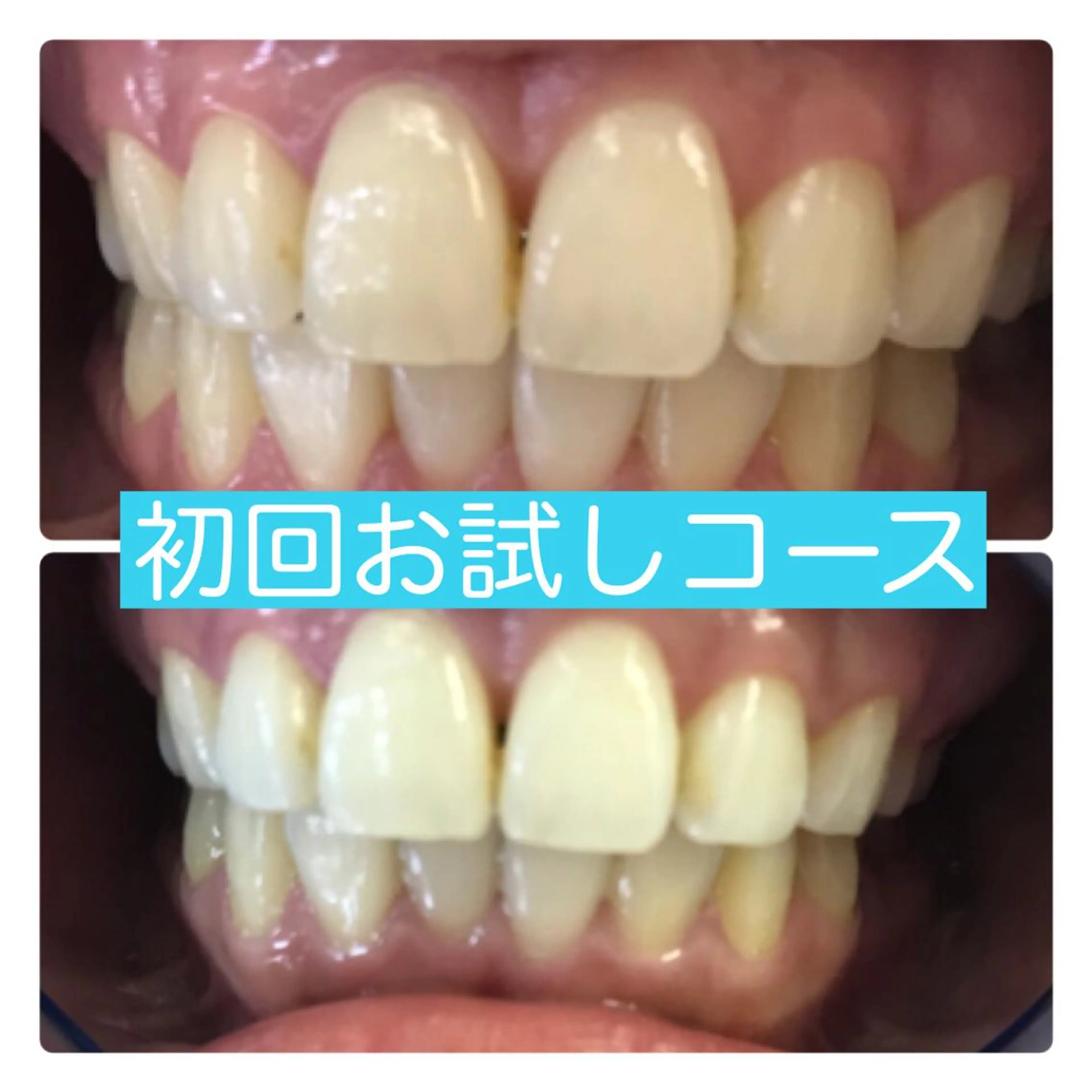 ホワイトニングルーム 横浜店のその他イメージ