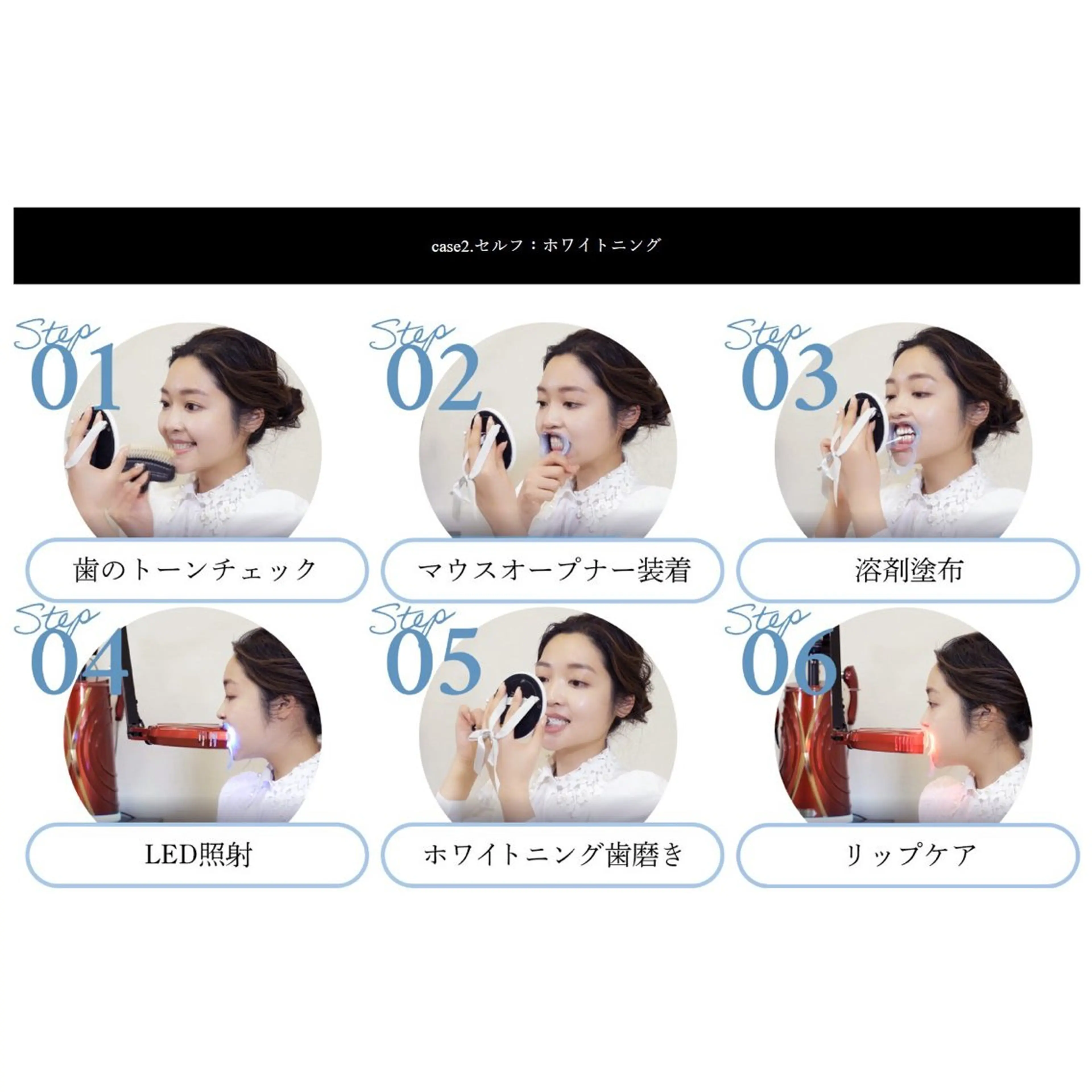 【アンケートにご協力いただける方限定】​〜​セルフホワイトニング​〜​30minの写真