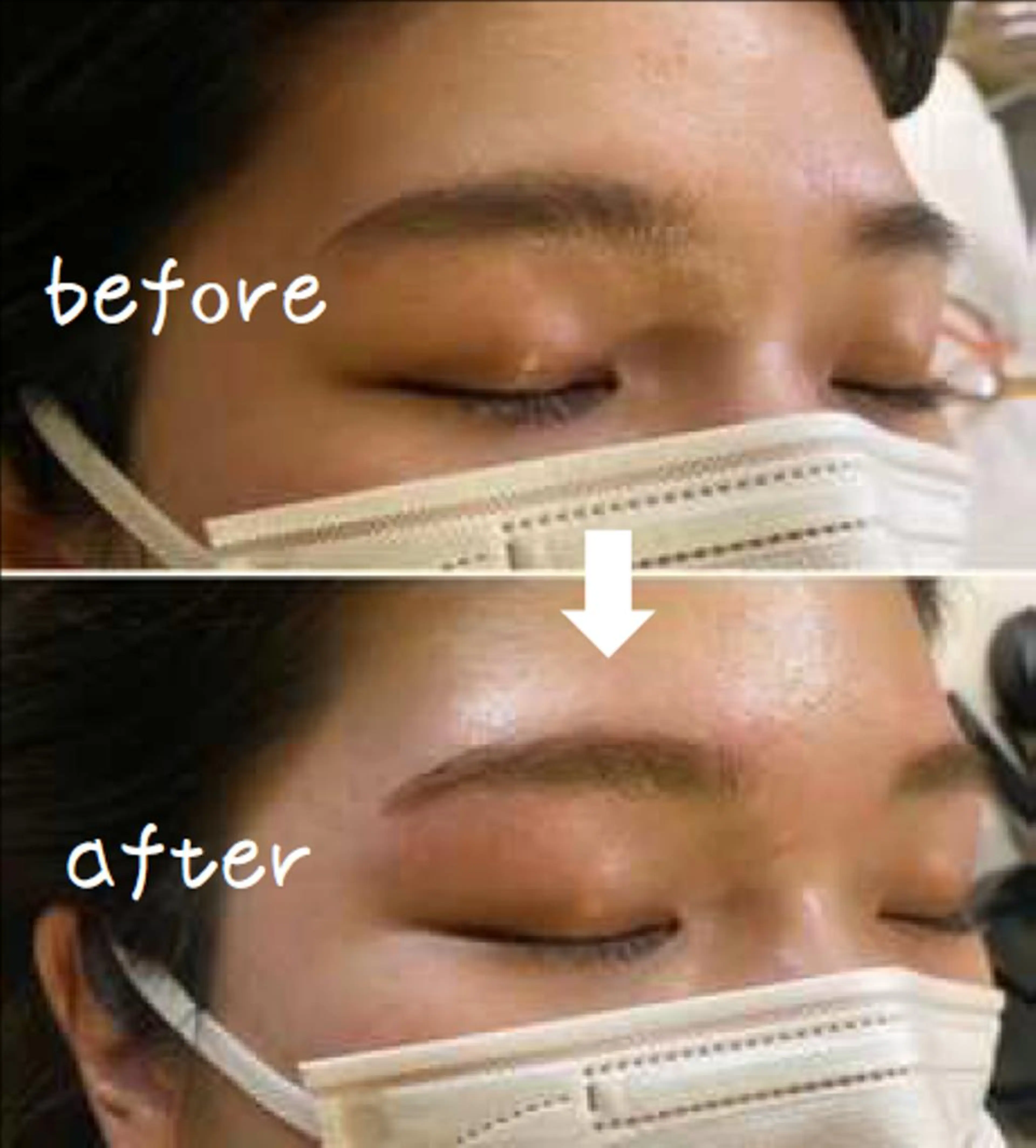 アイブロウ ハリウッドブロウリフト 眉毛ワックス脱毛 ワックス脱毛 その他(アイブロウ) 美肌専門サロン かれんのエステ・リラクイメージ