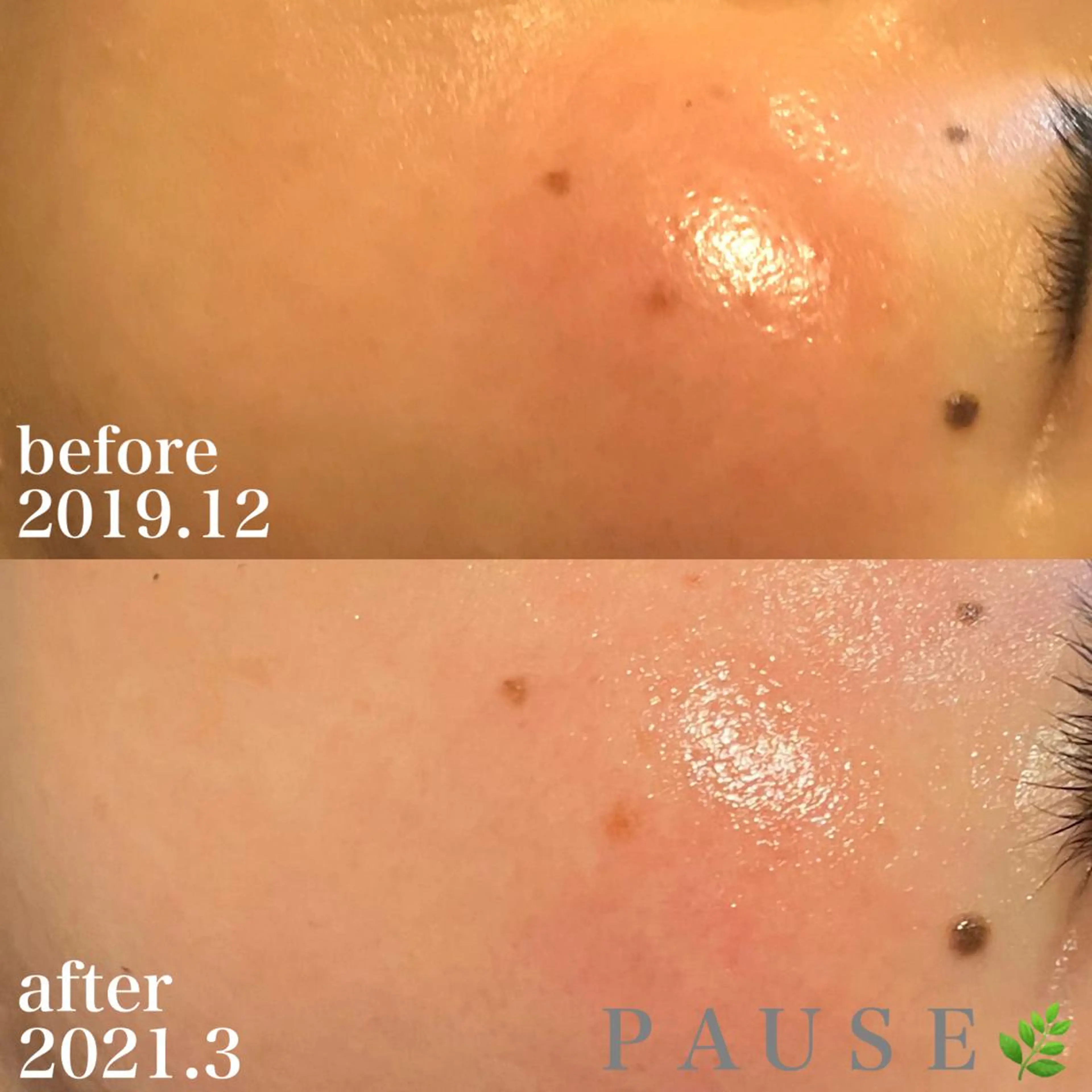 エステ リラク 浜野 恵美のエステ・リラクイメージ