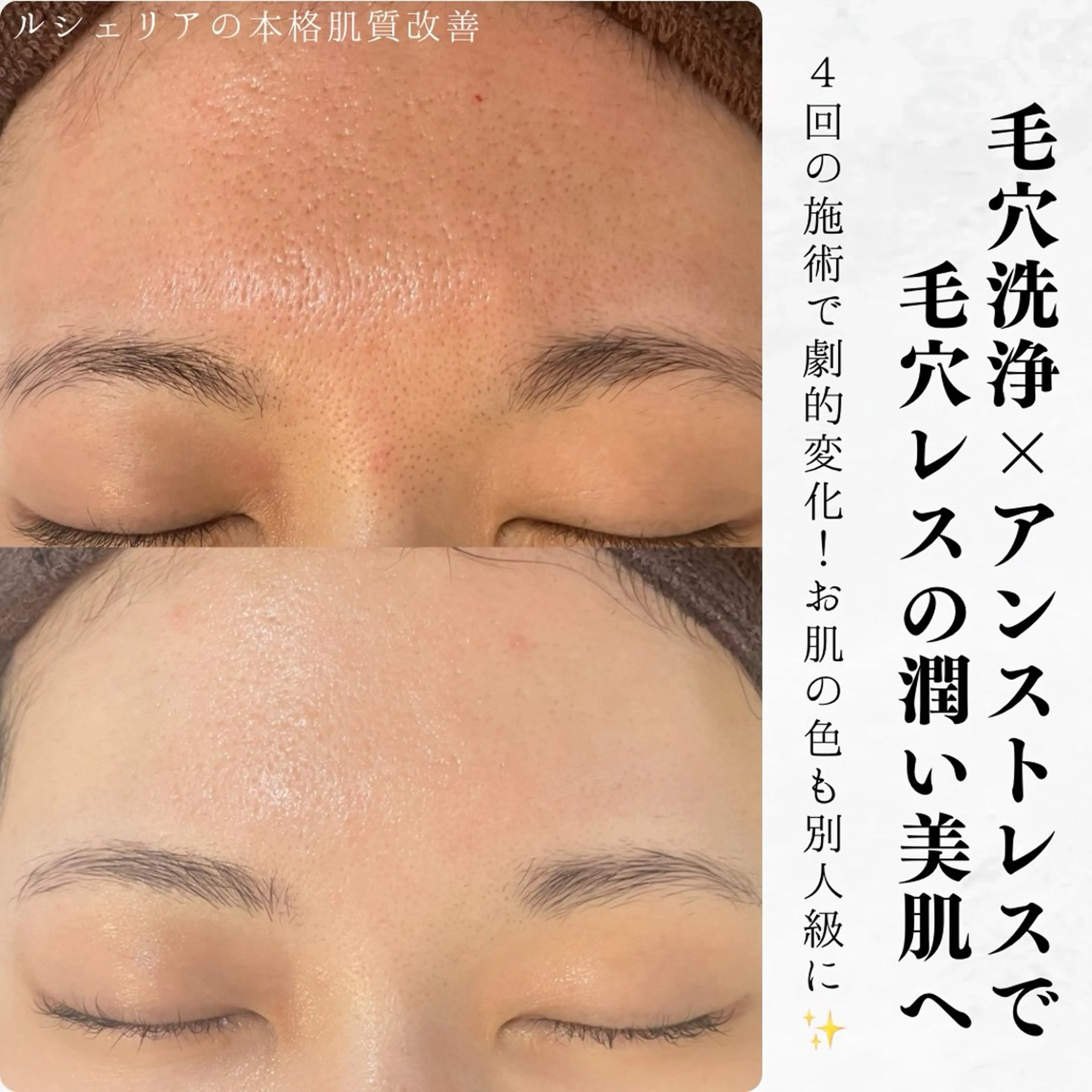 水光肌への近道🫧【CHRISTINAアンストレス】の写真