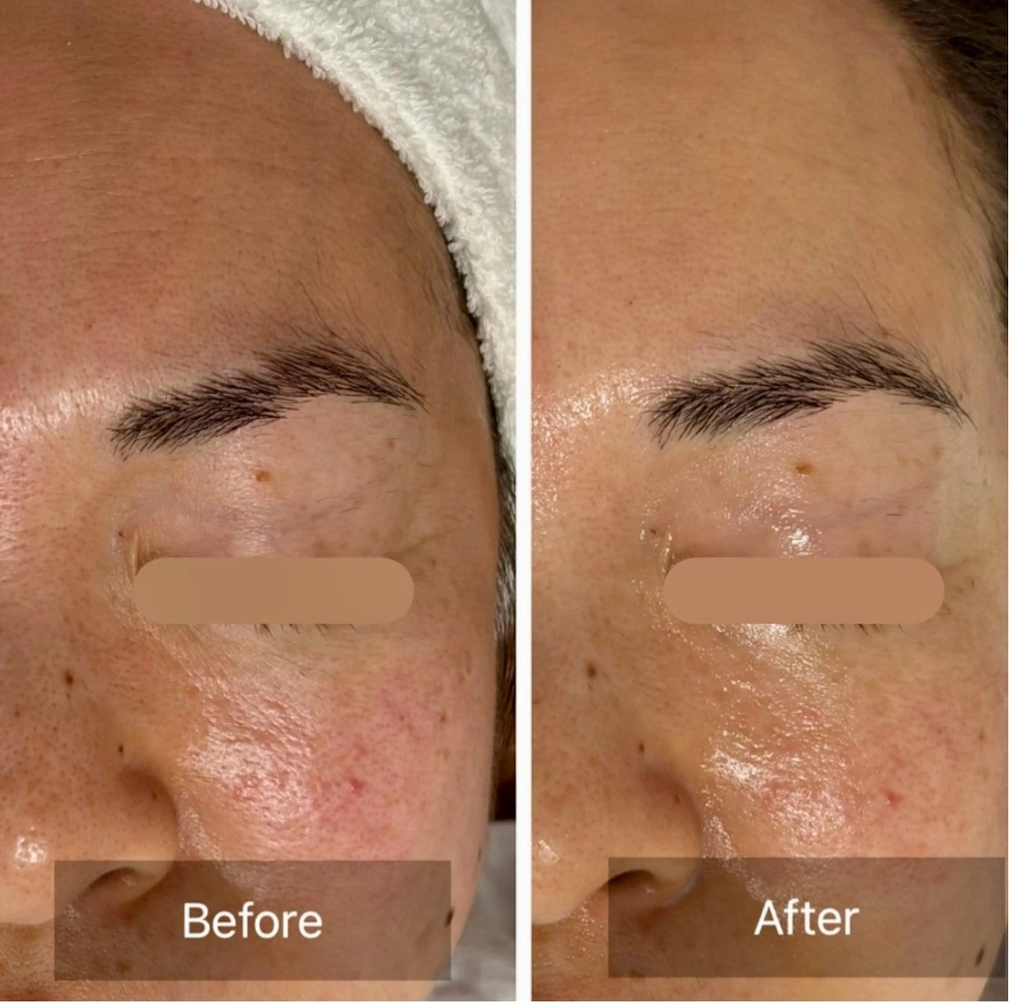 【シミくすみ悩み】オールハンドフェイシャル✨の写真