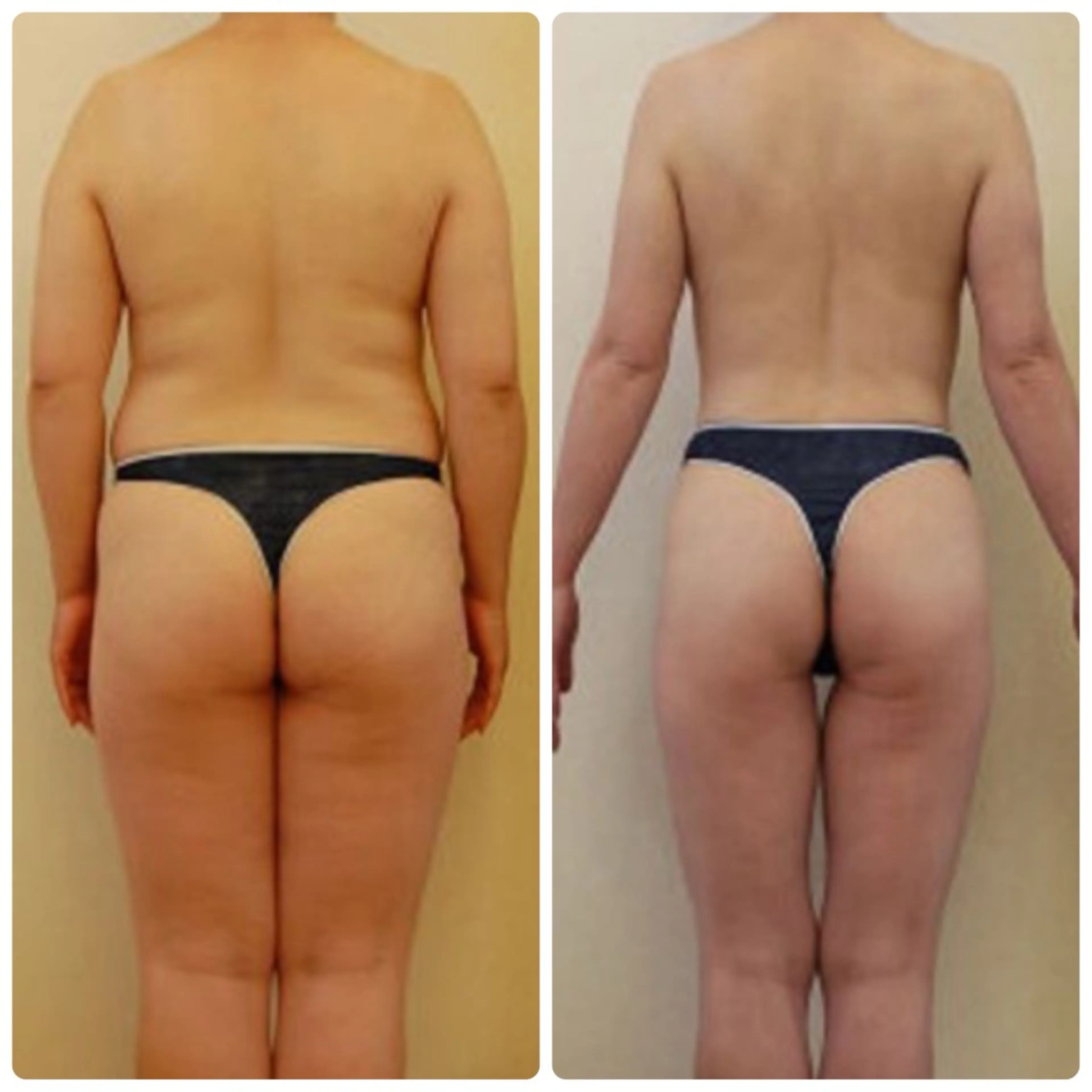 エステ Re:Oasis所属・🦋痩身専門サロン Re:oasis🦋のエステ・リラクイメージ