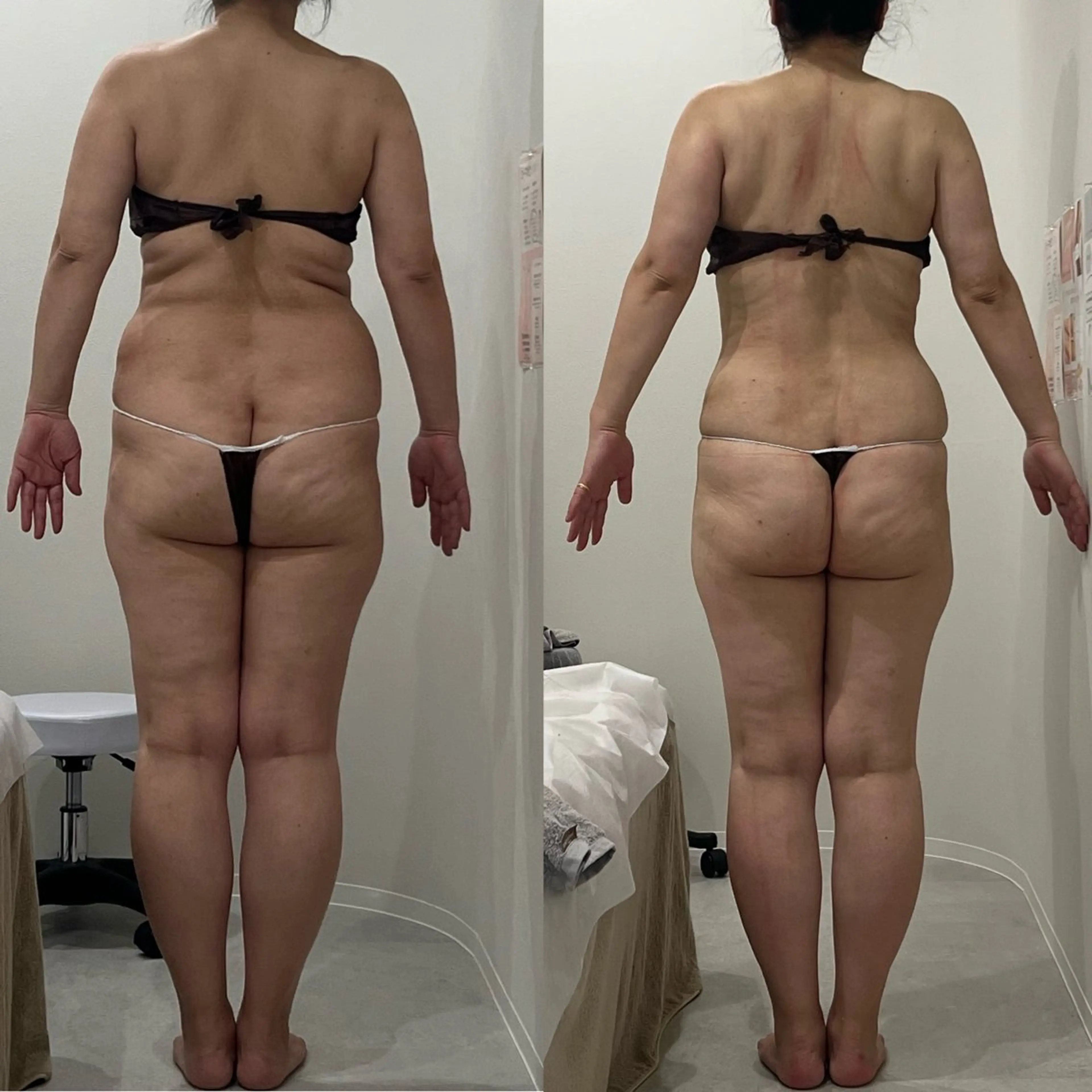 Asmy 神戸三宮店のエステ・リラクイメージ