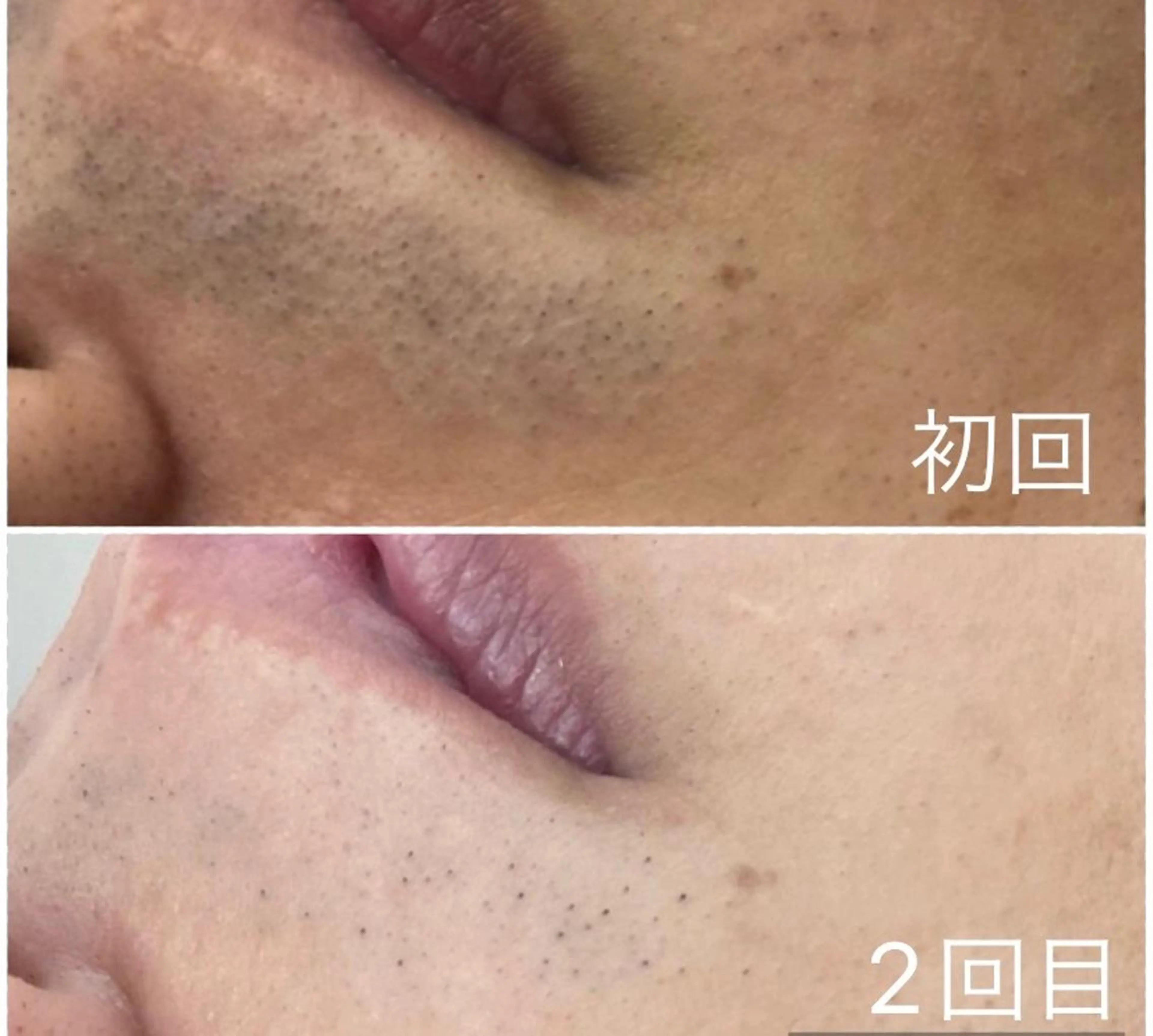 classynail beautyのエステ・リラクイメージ