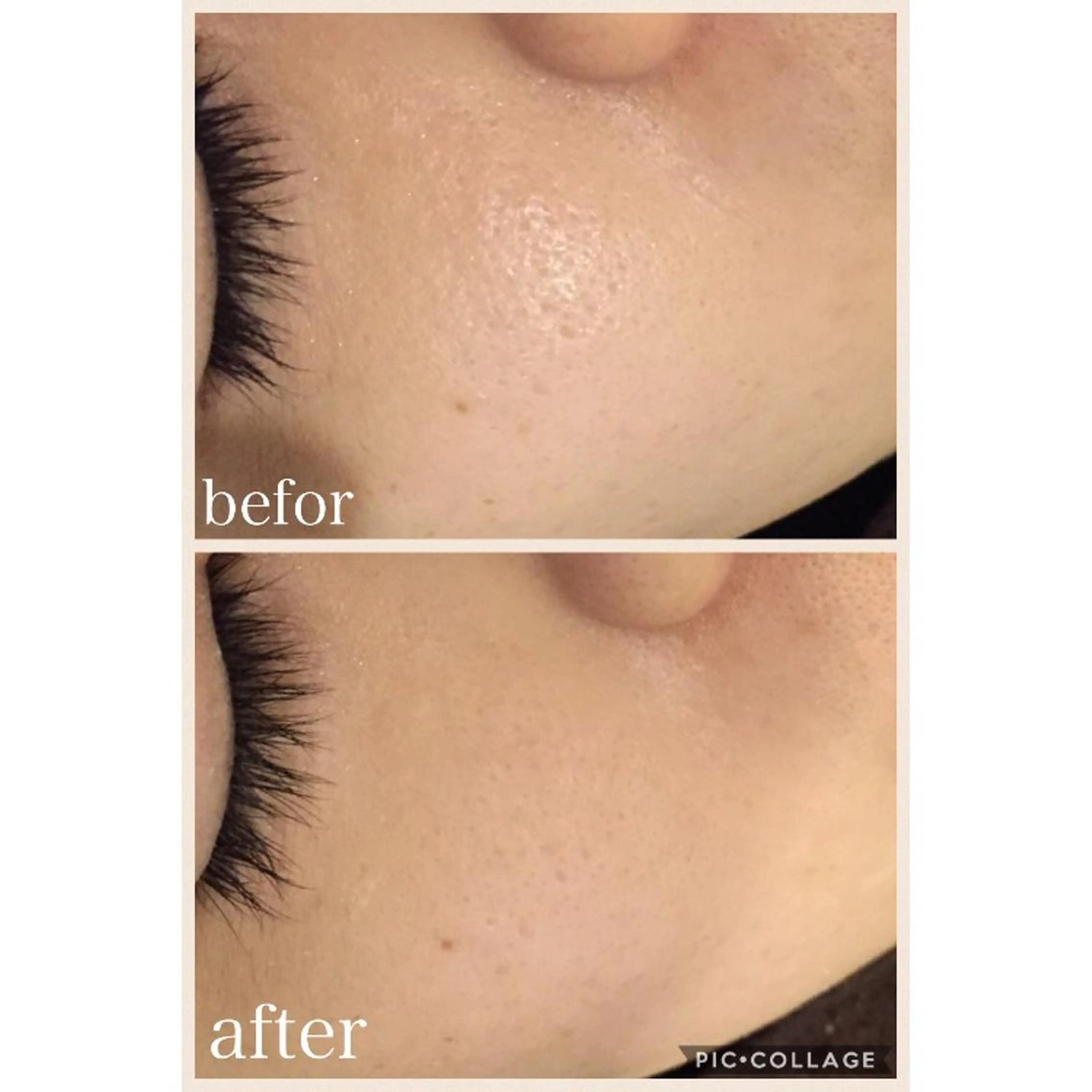 ニキビ跡専門サロン Ａｉｎａのエステ・リラクイメージ