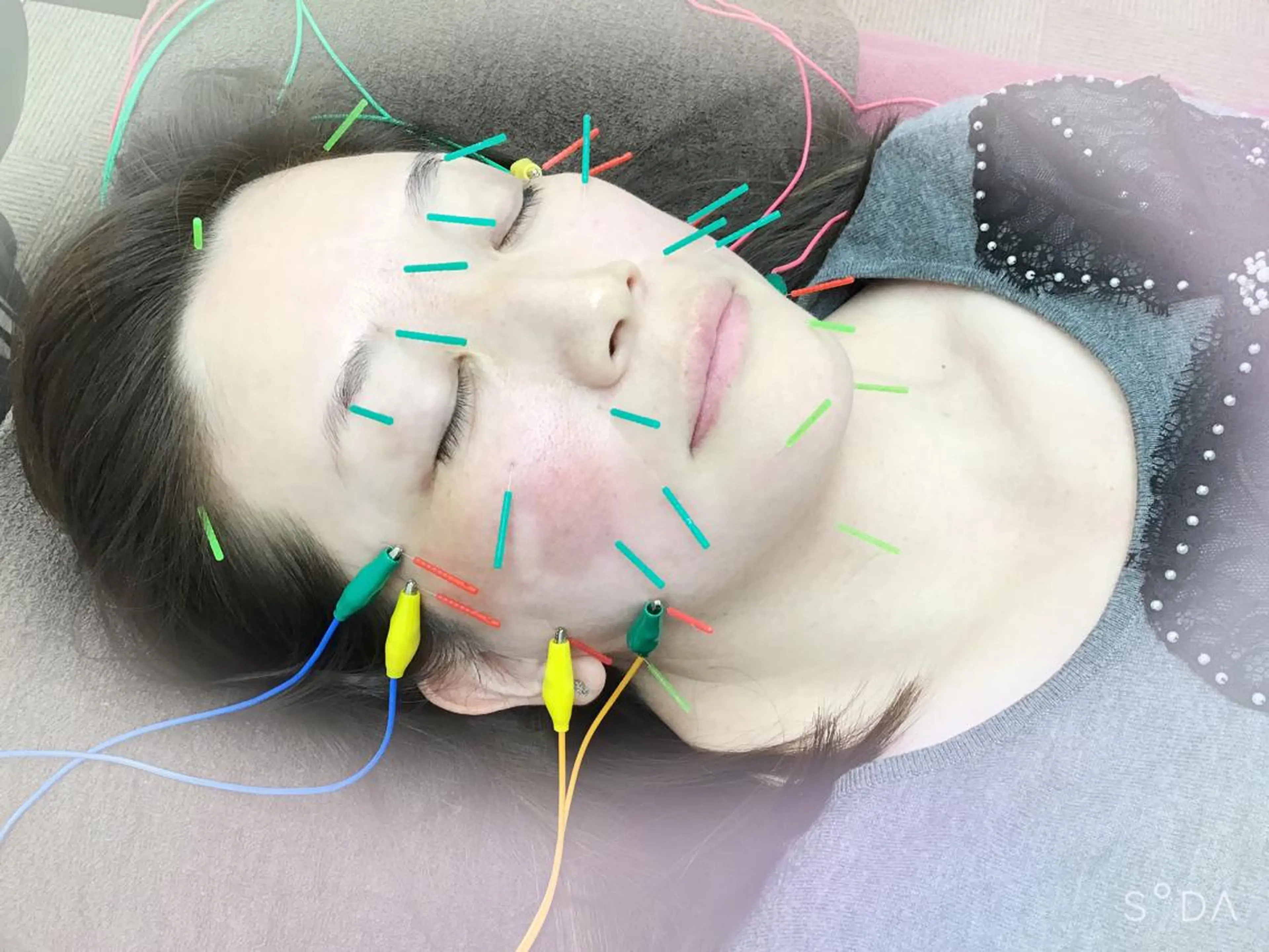 エステ リラク まごころ鍼灸整骨院 京王堀之内院のエステ・リラクイメージ