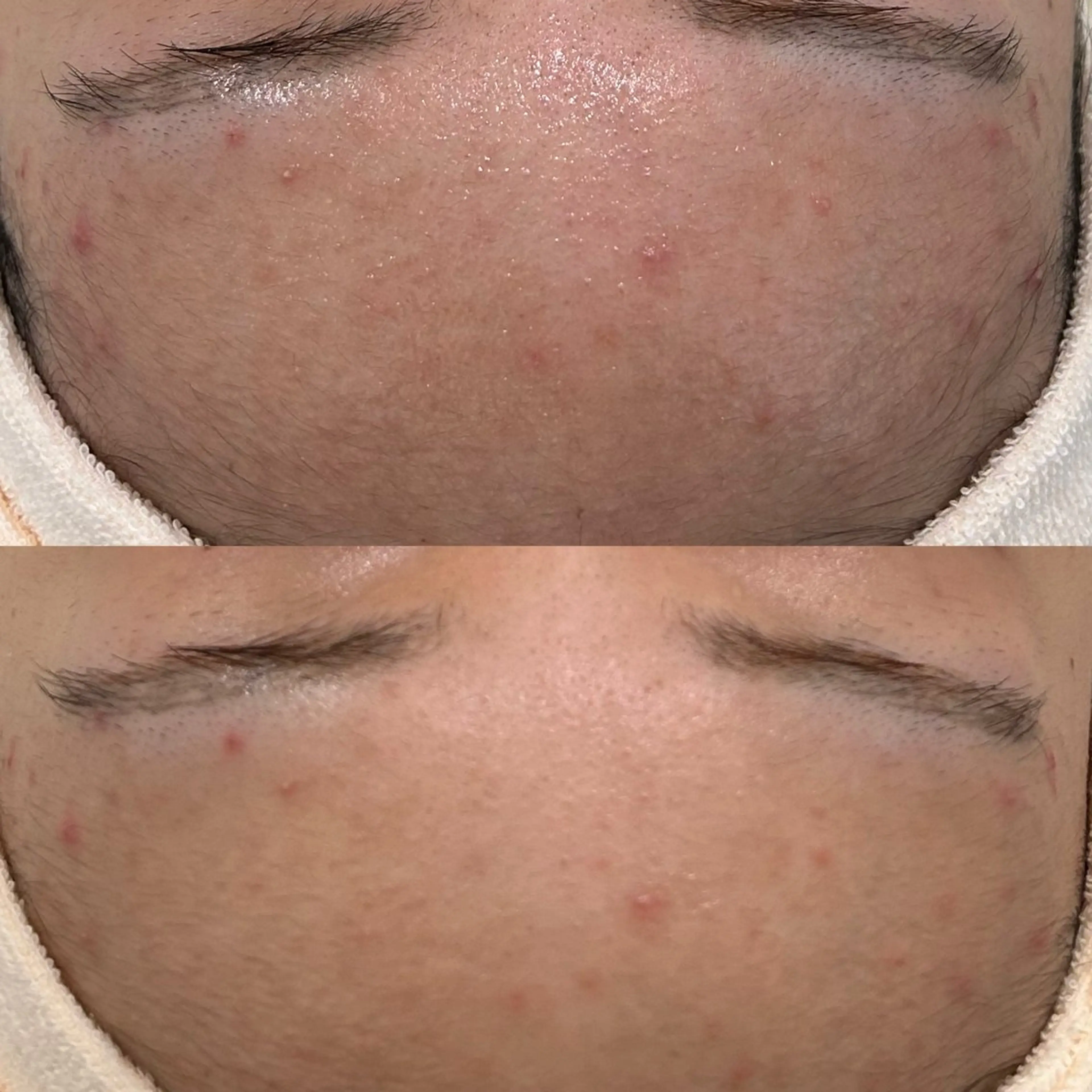 etre - 韓国肌管理 -のエステ・リラクイメージ