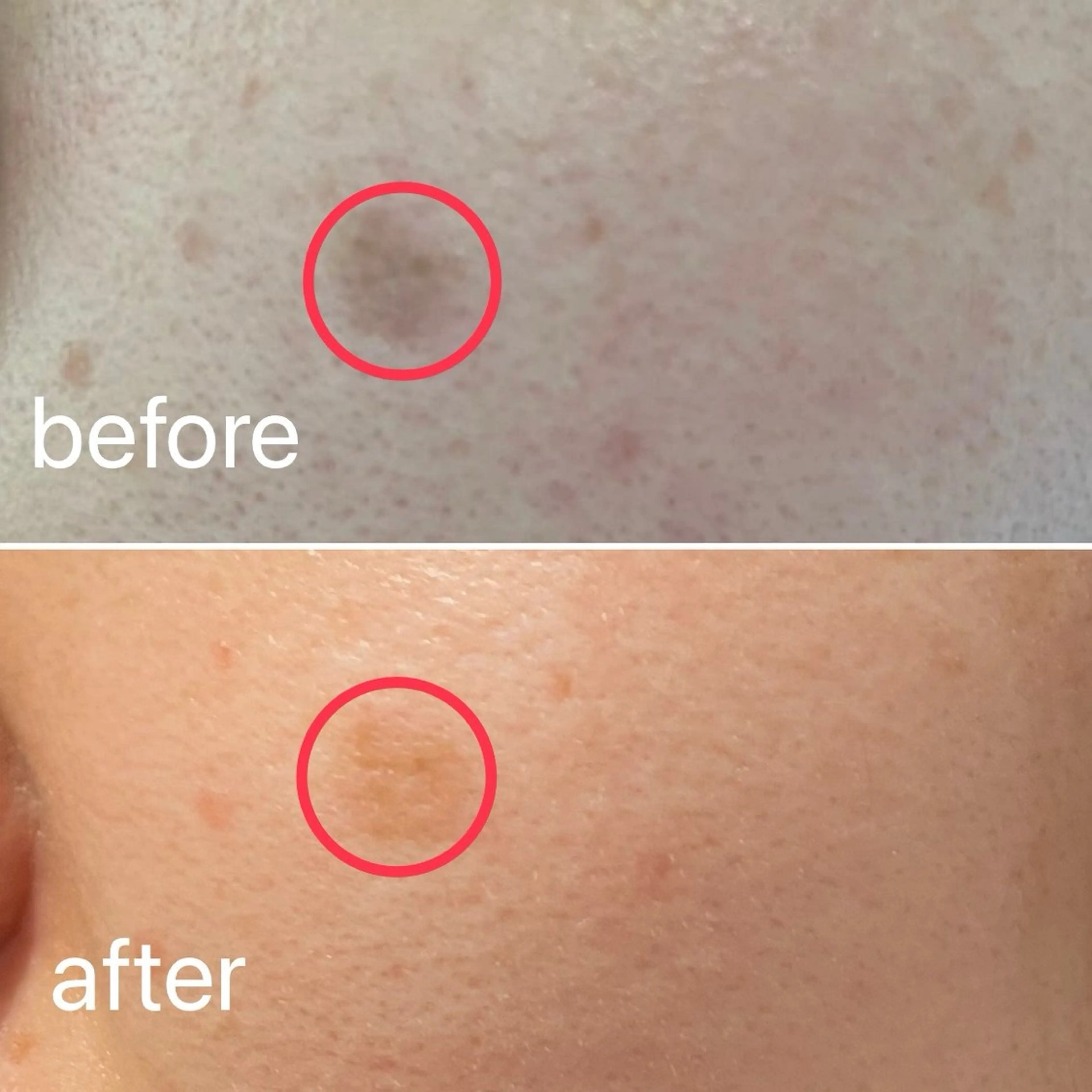 痛くないシミ取り 【荻窪】石橋のヘアスタイル