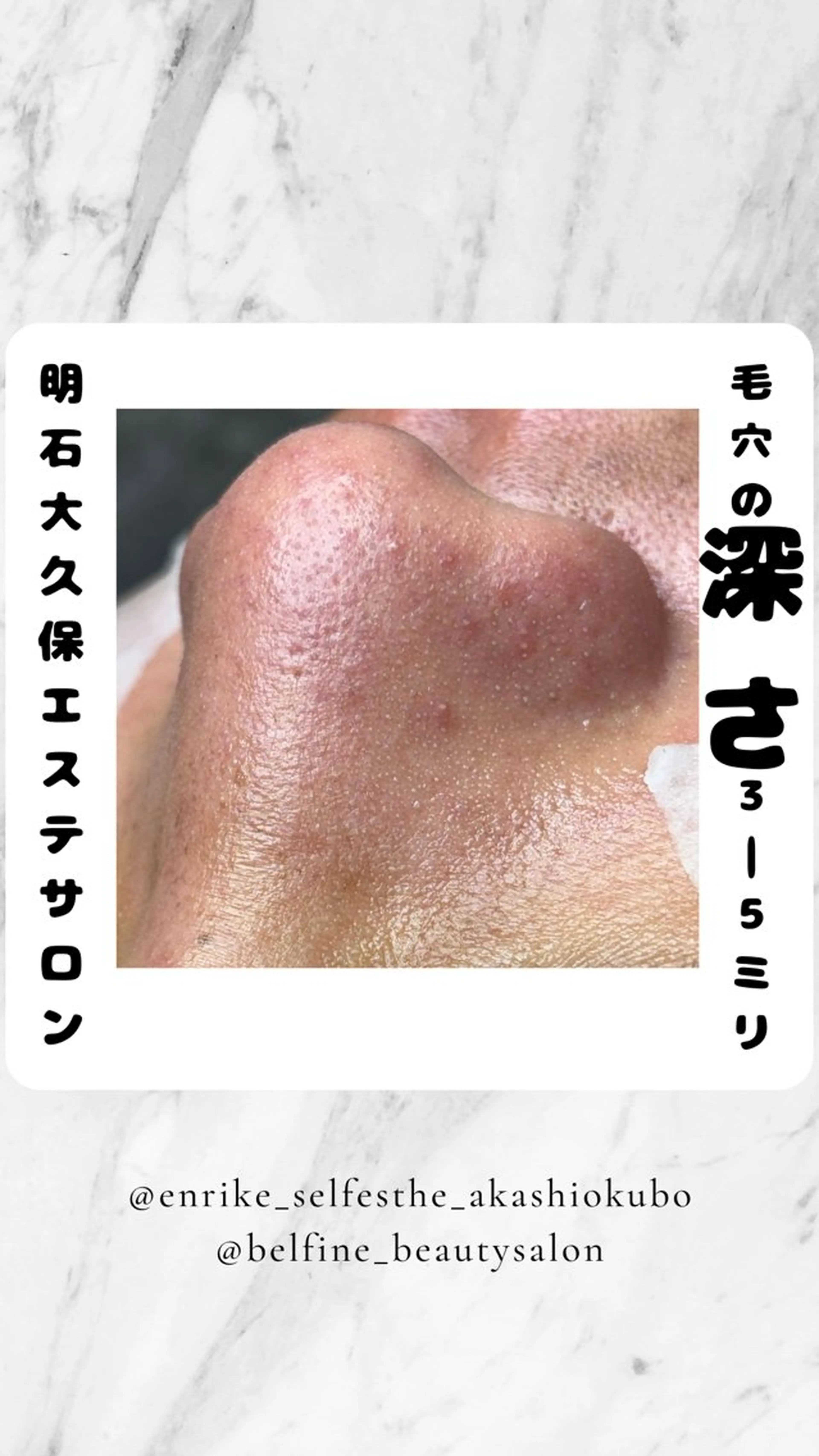 夕希 毛穴と脱毛特化サロンのエステ・リラクイメージ