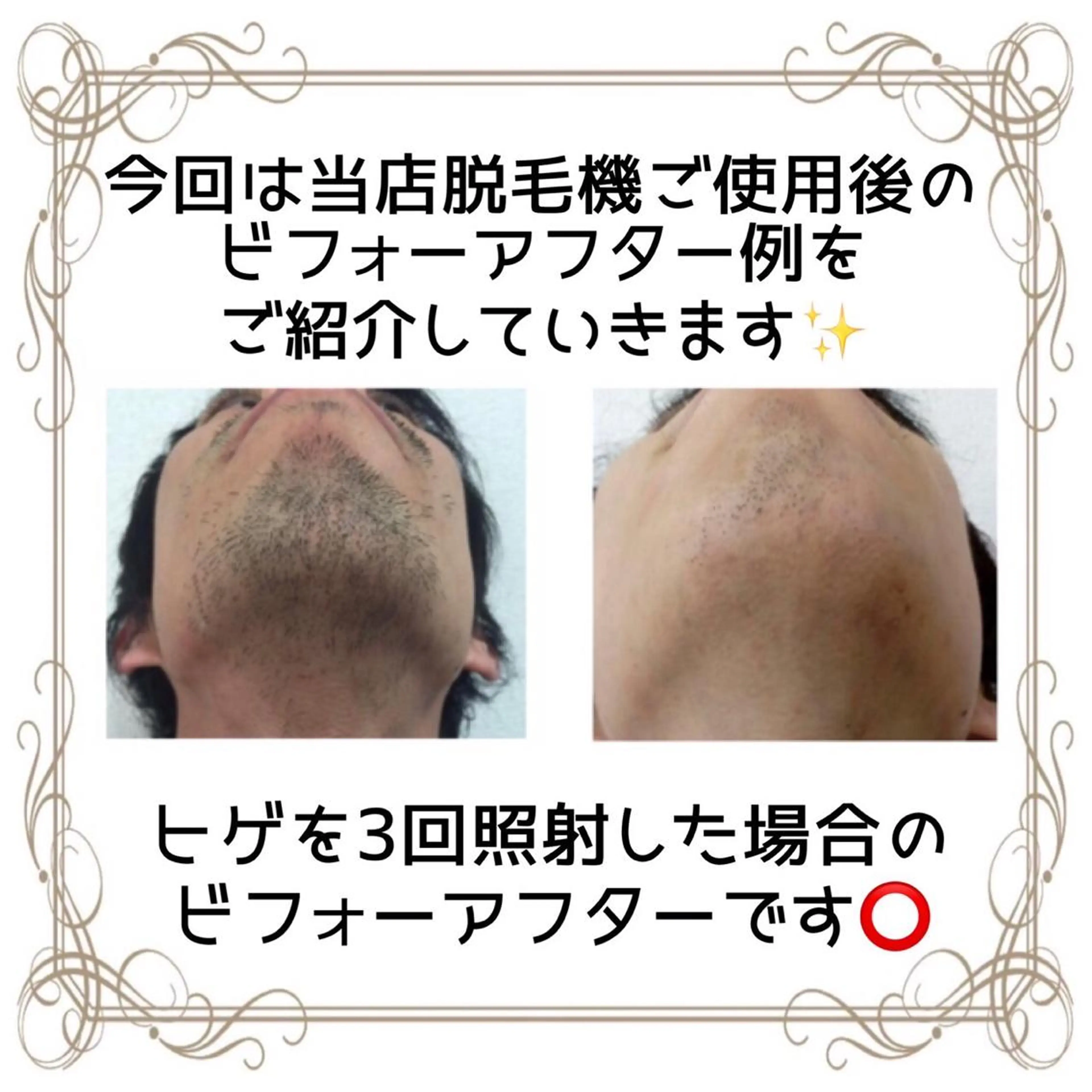 脱毛 セルフエステサロン BATONのエステ・リラクイメージ