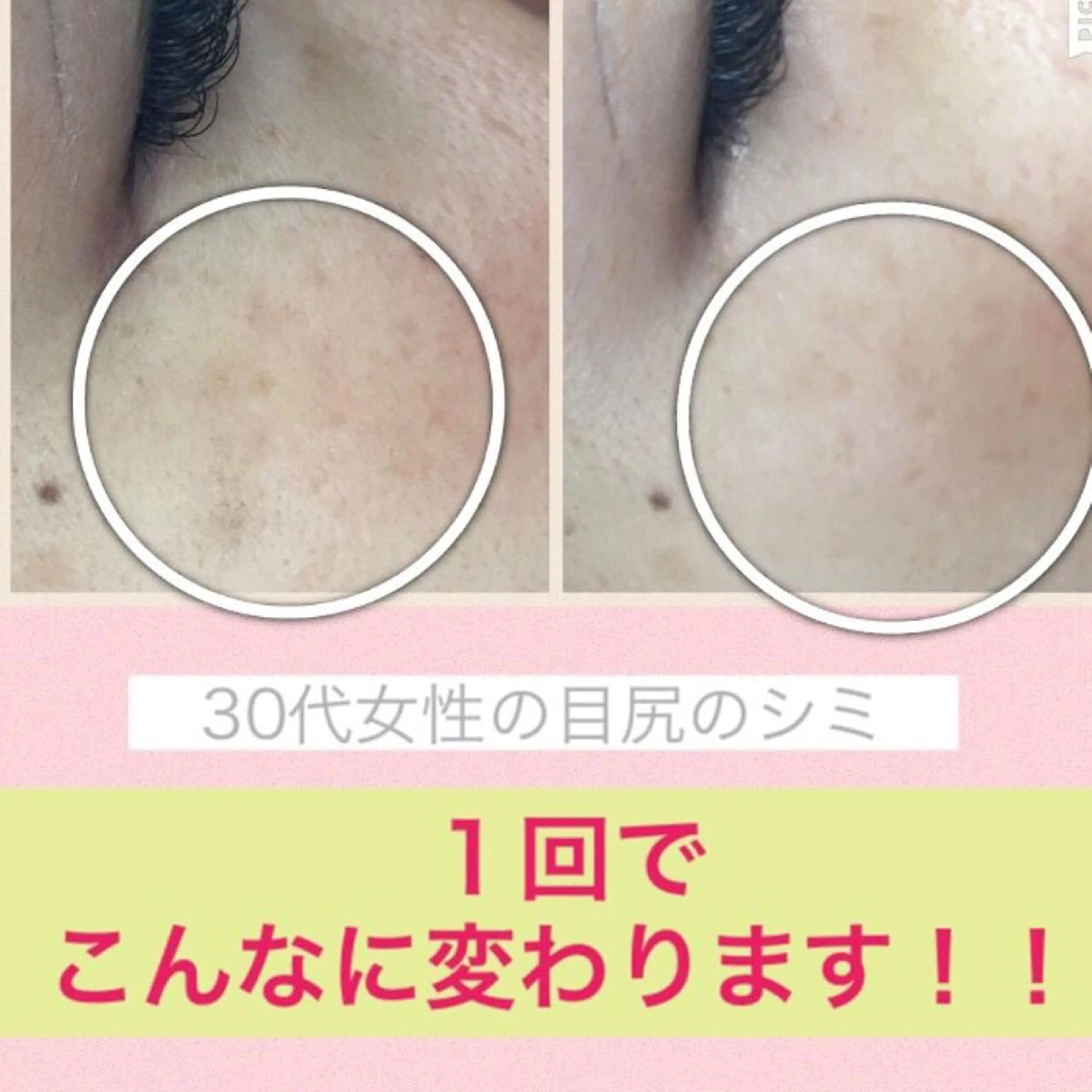 ミディアム カラー パーマ ヘアアレンジ メンズ キッズ ネイル マツエク・マツパ エステ リラク ニキビ・肌質改善専門 ♡人生が変わるサロンのエステ・リラクイメージ