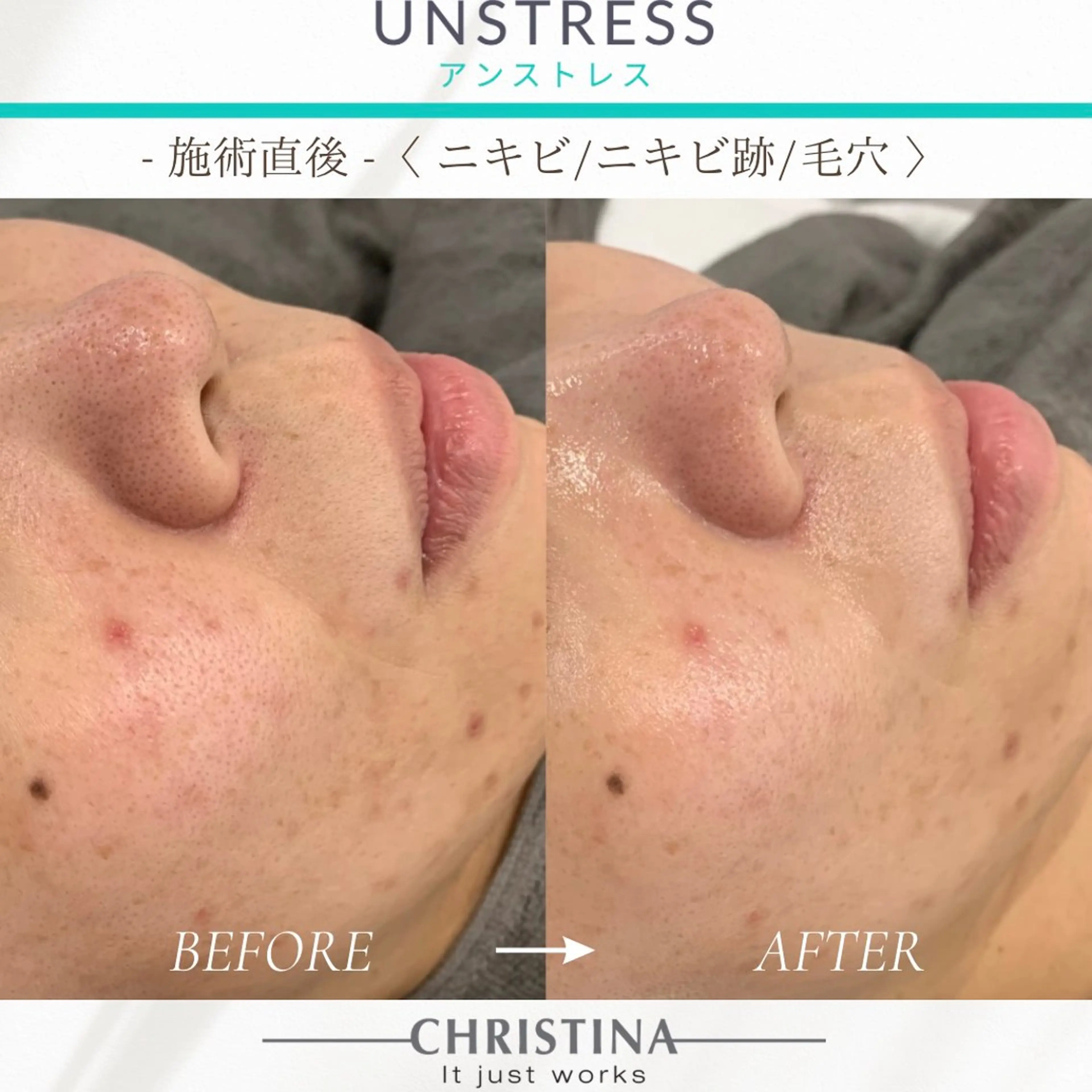 THE SALON -esme-のマツエク・マツパデザイン