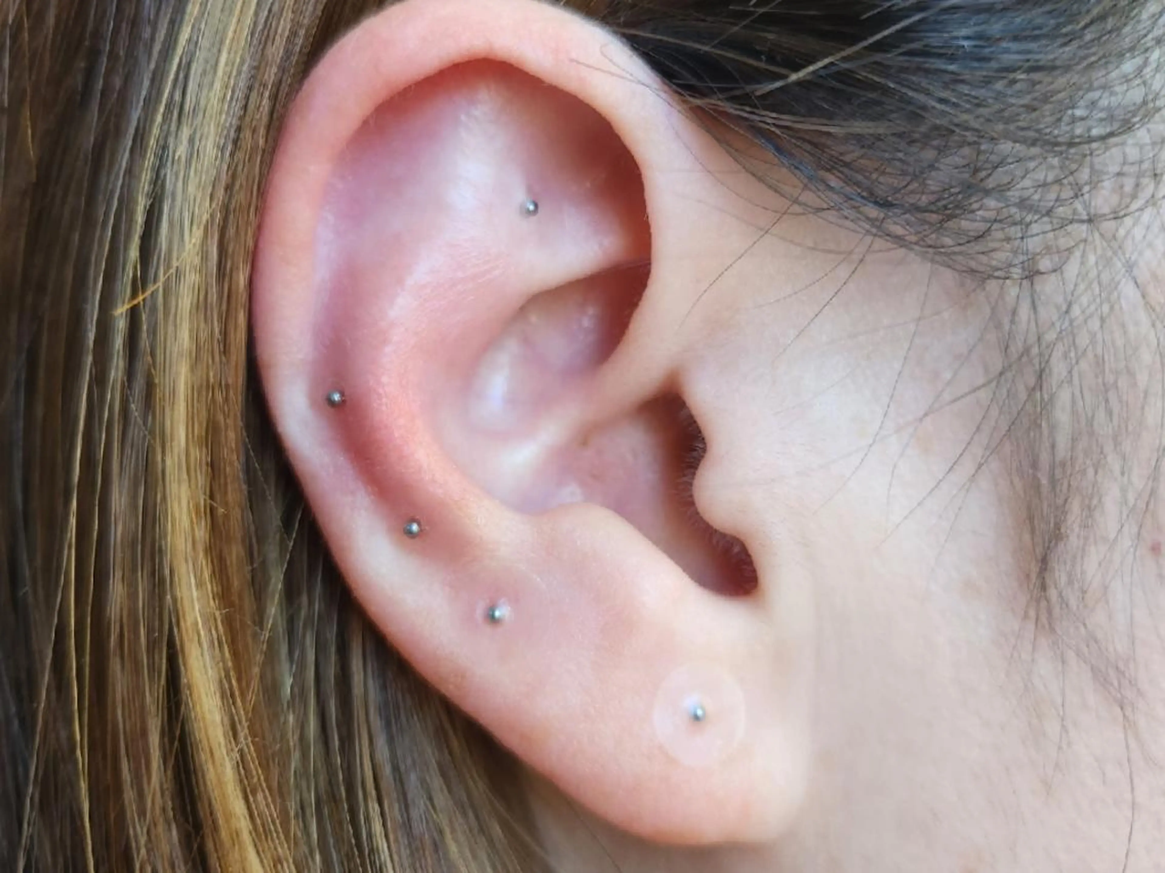 4月限定価格‼美白or乾燥保湿フェイシャルトリートメント&耳ツボ(シール付き)の写真