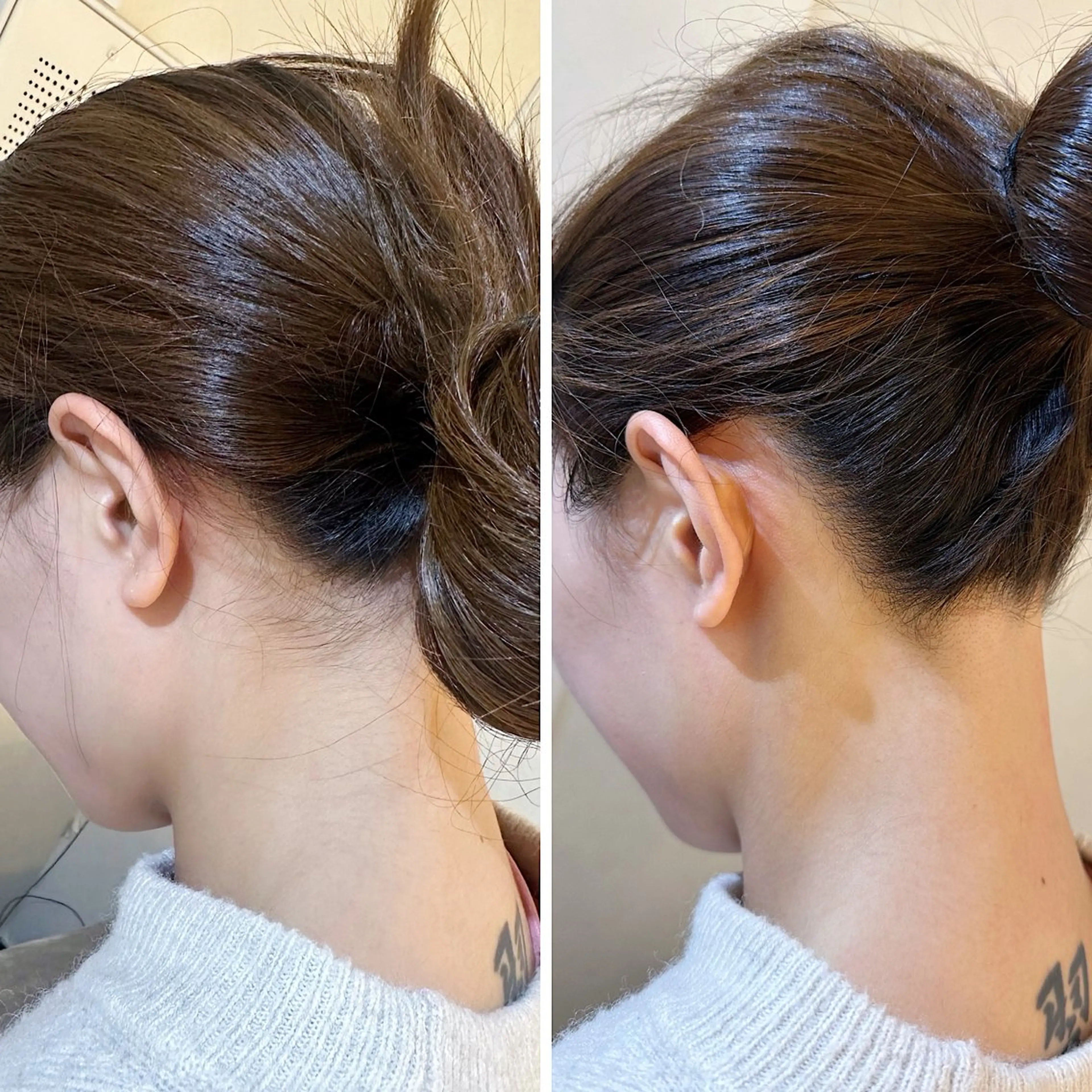 脱毛 うなじ脱毛/美肌脱毛 LABELのエステ・リラクイメージ