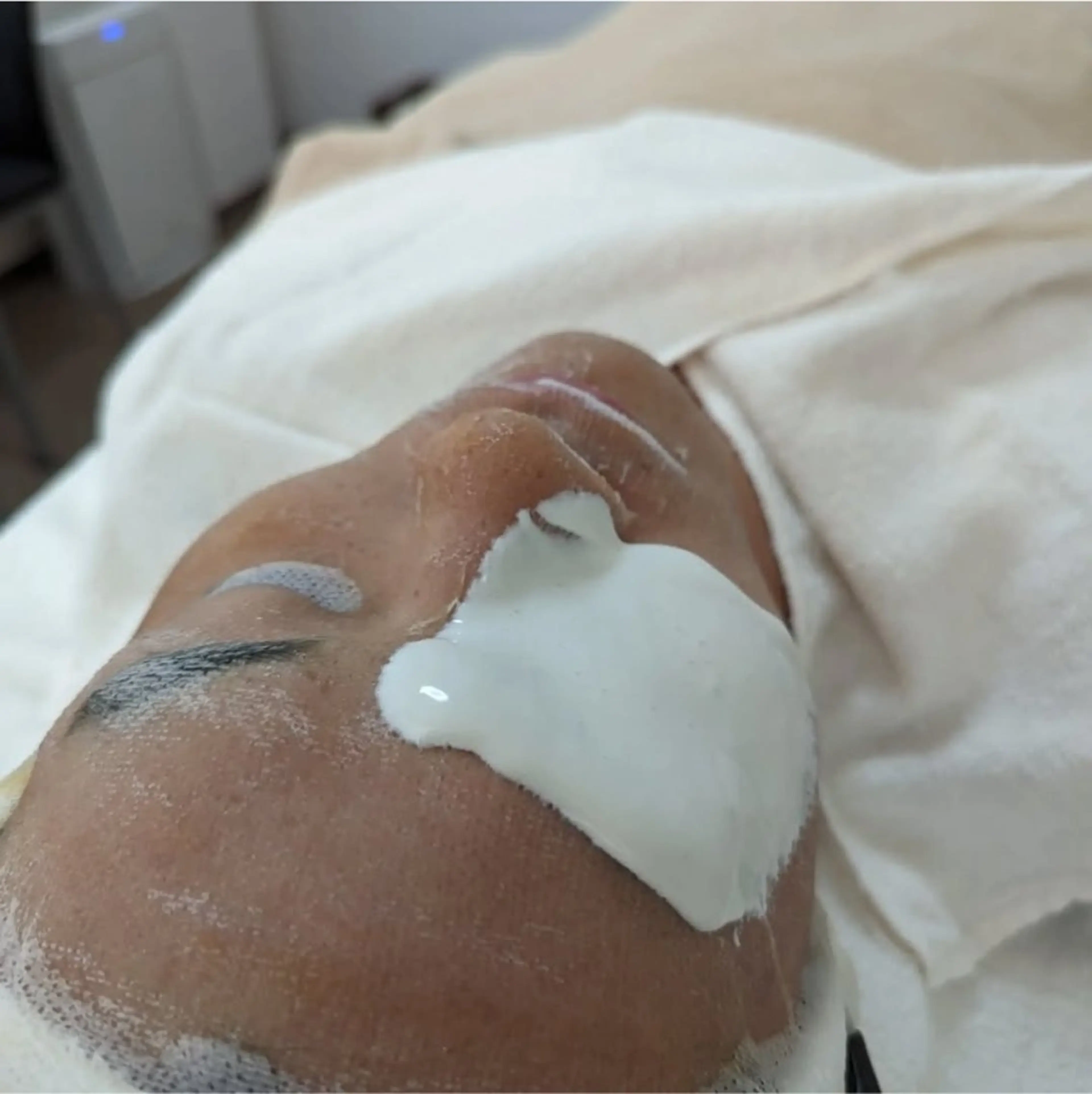 〈ニキビケアサロン〉 レゾン京橋店/ 浅川のエステ・リラクイメージ