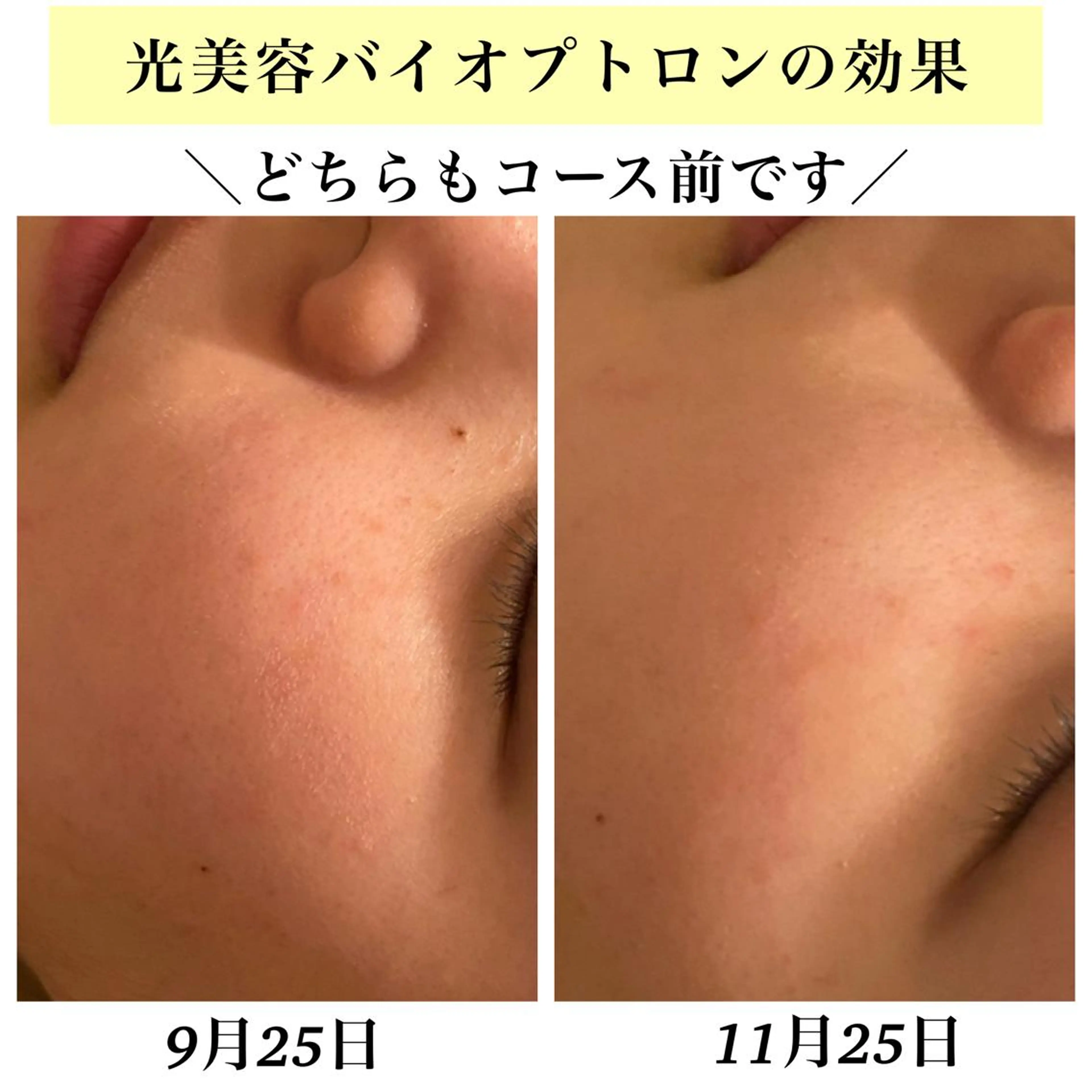 Bellesthe （ベルエステ）のエステ・リラクイメージ