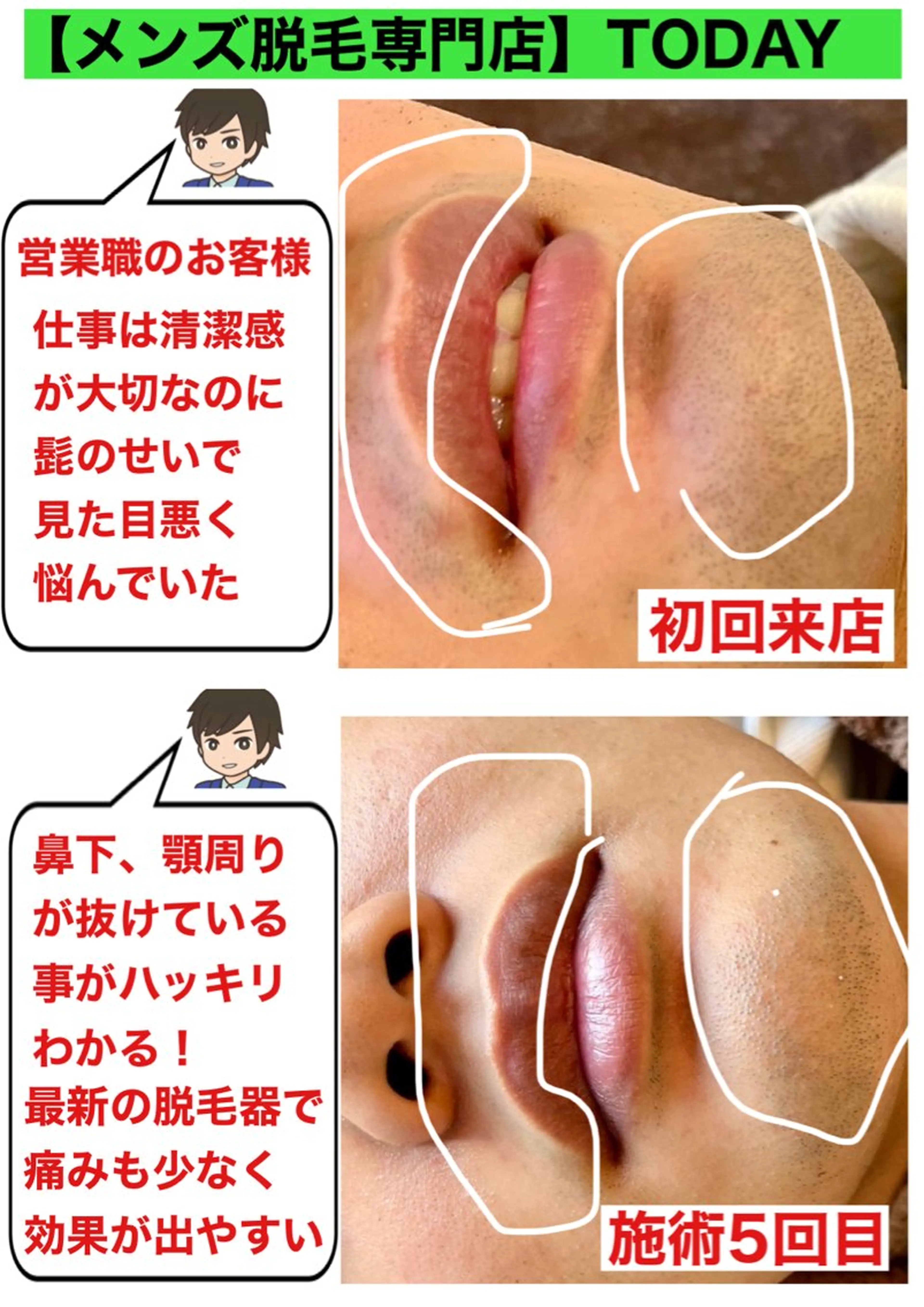 メンズ 【メンズ脱毛専門店】TODAY所属・都度払い制メンズ脱毛 オーナーのエステ・リラクイメージ
