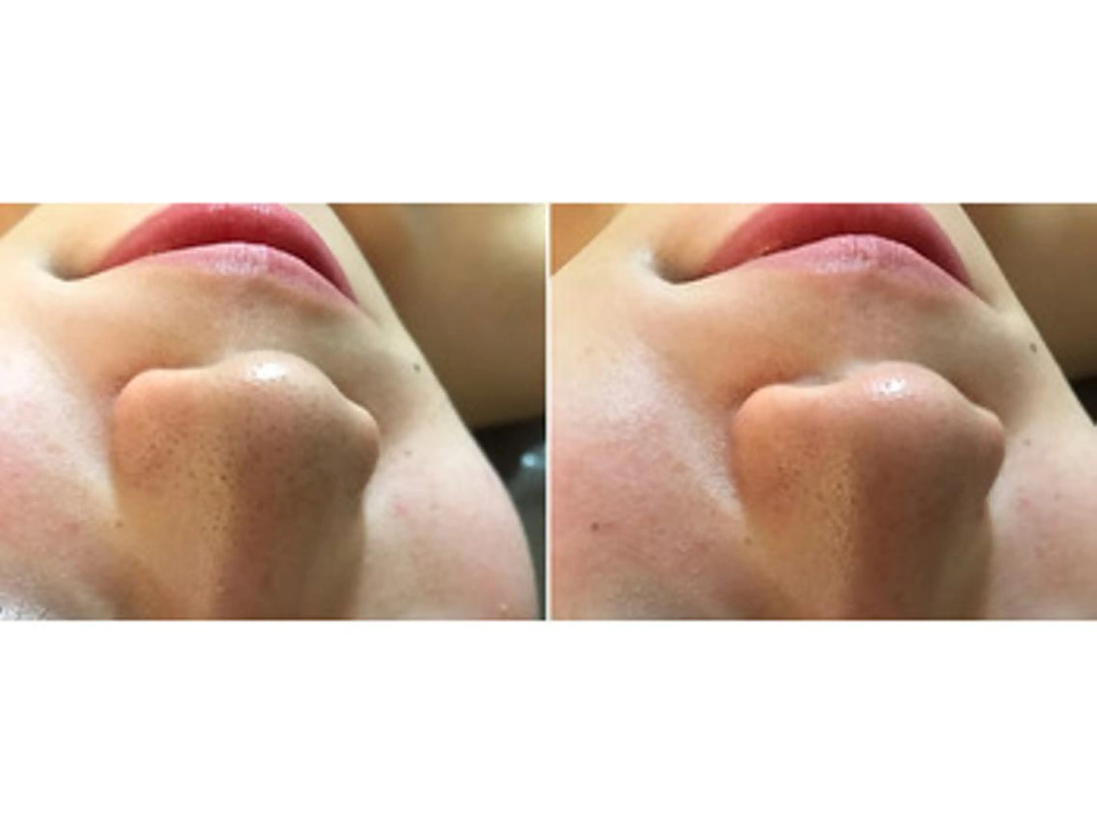 バストケア RAYVIS梅田店Nのエステ・リラクイメージ