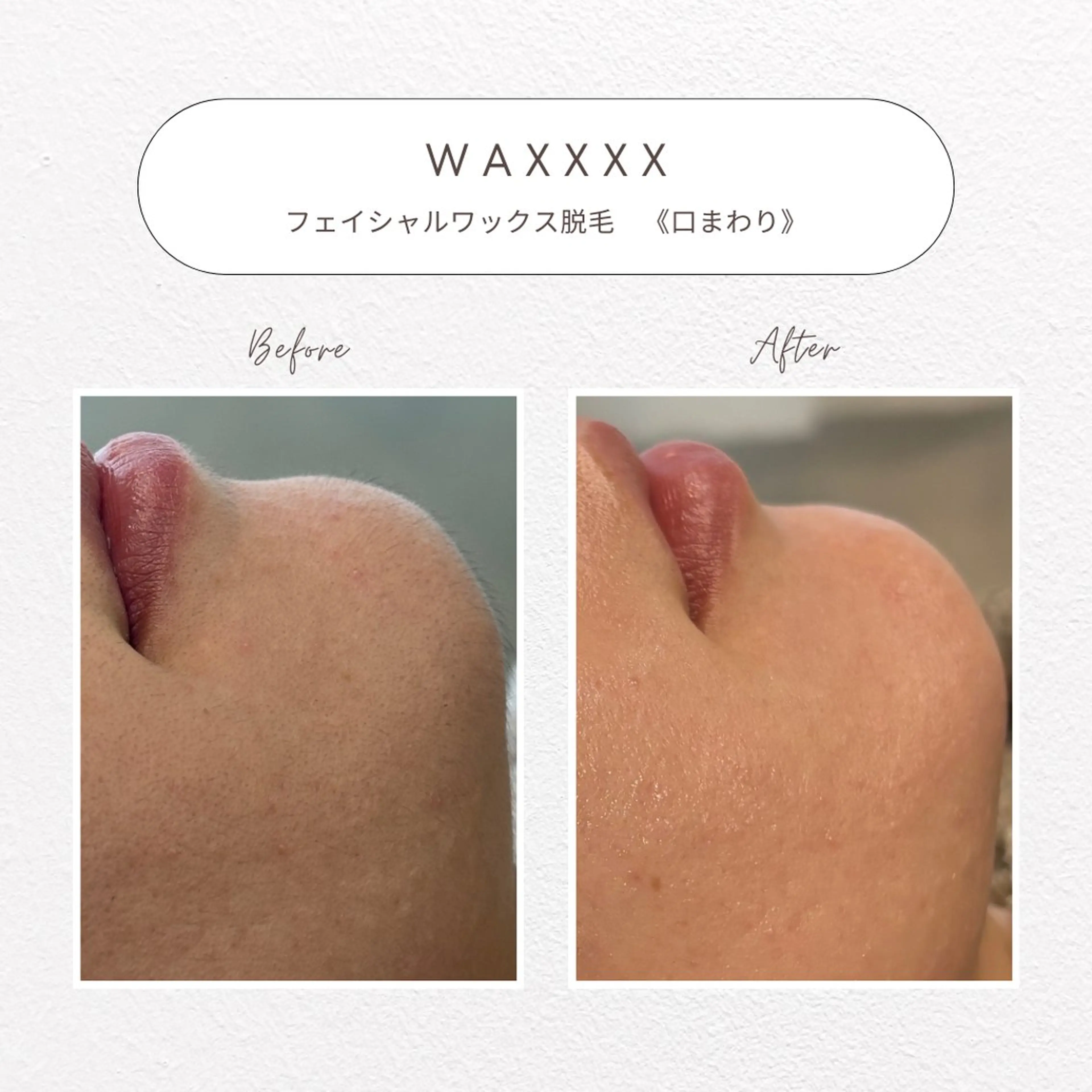 beaute LABO所属・大宮肌管理サロン sayakaのエステ・リラクイメージ