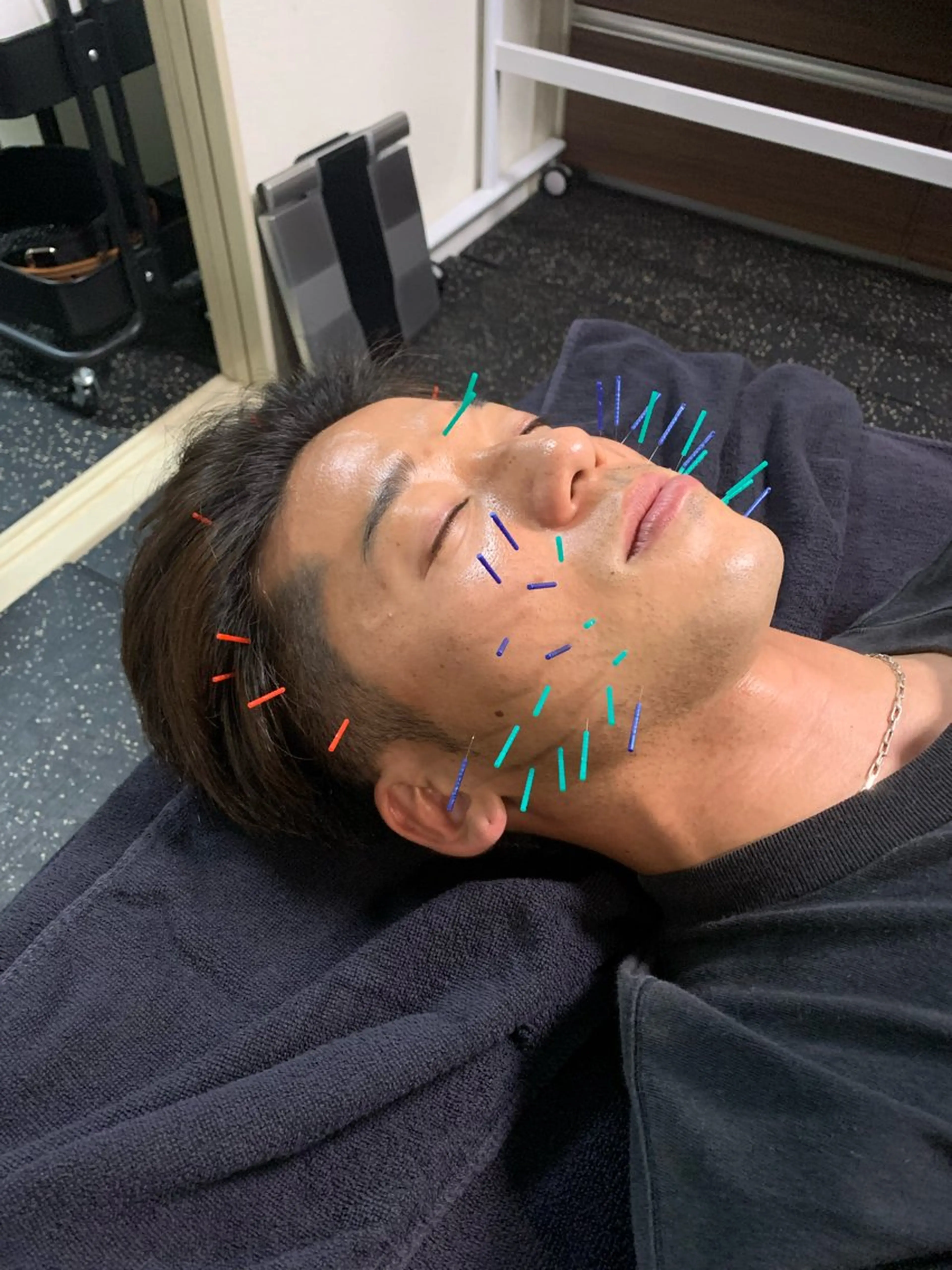 エステ リラク 小顔矯正・美容鍼 FLOW鍼灸整体院のエステ・リラクイメージ