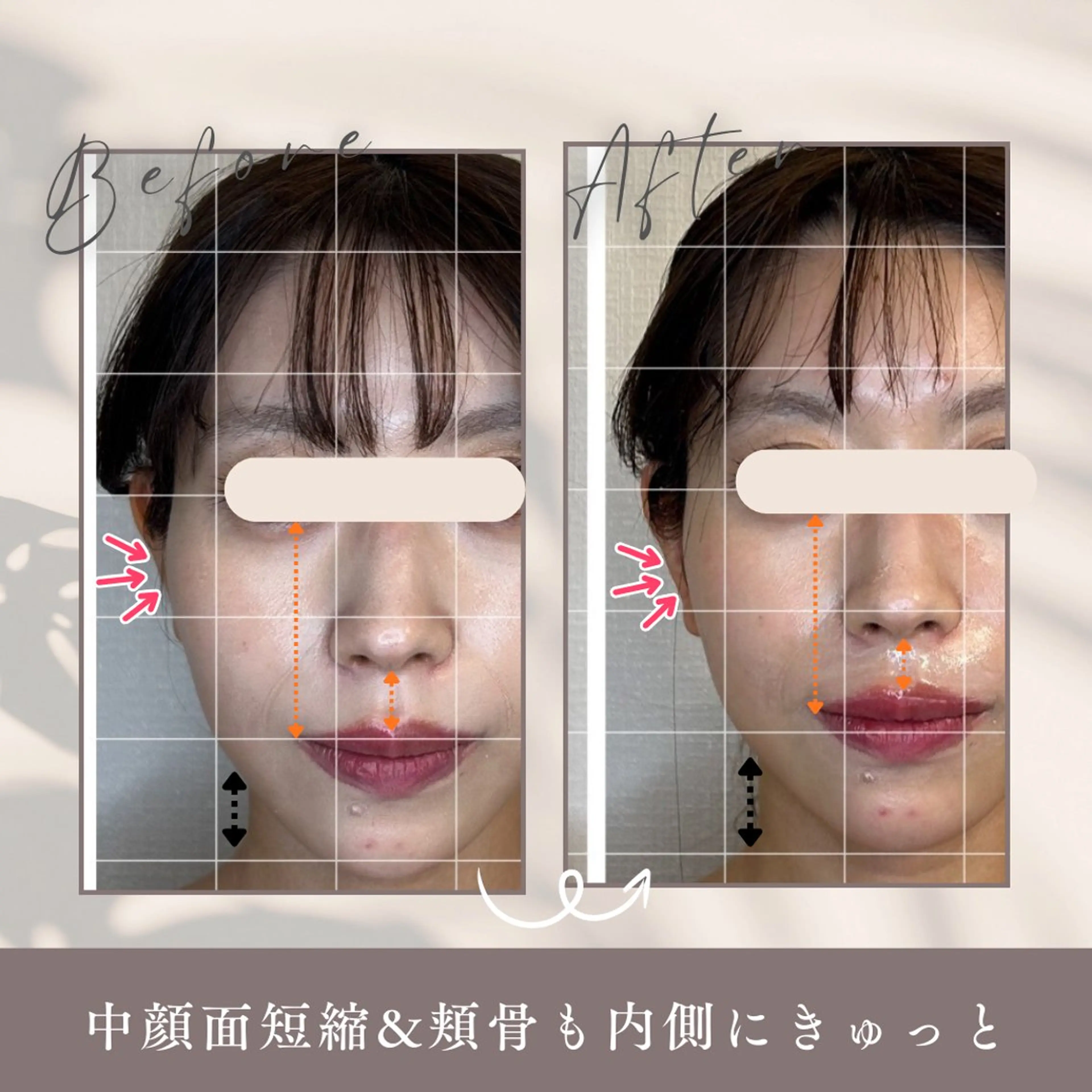 エステ リラク 小顔セラピー LILのエステ・リラクイメージ