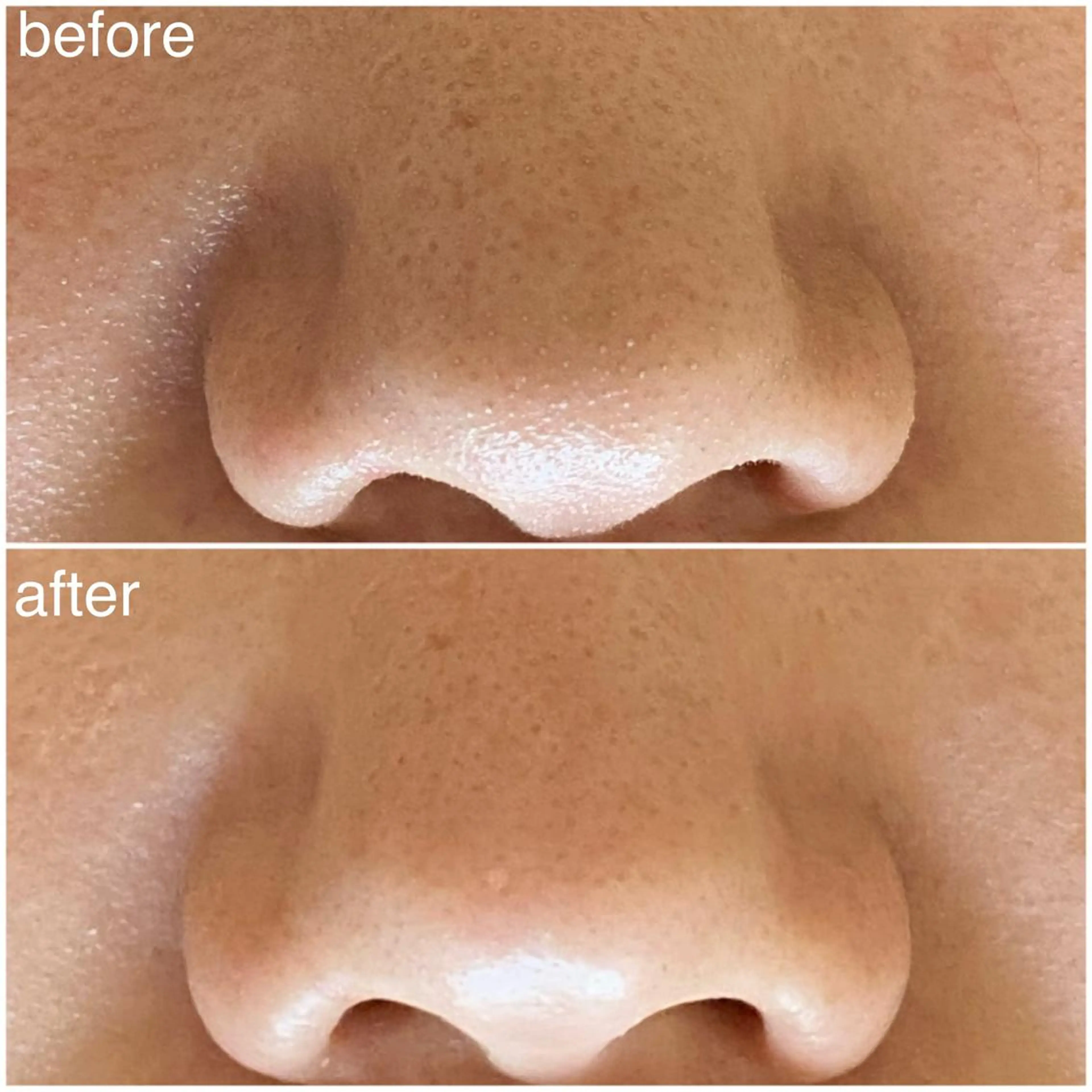 毛穴専門サロン フルール所属・フルールFululu 自由が丘のエステ・リラクイメージ