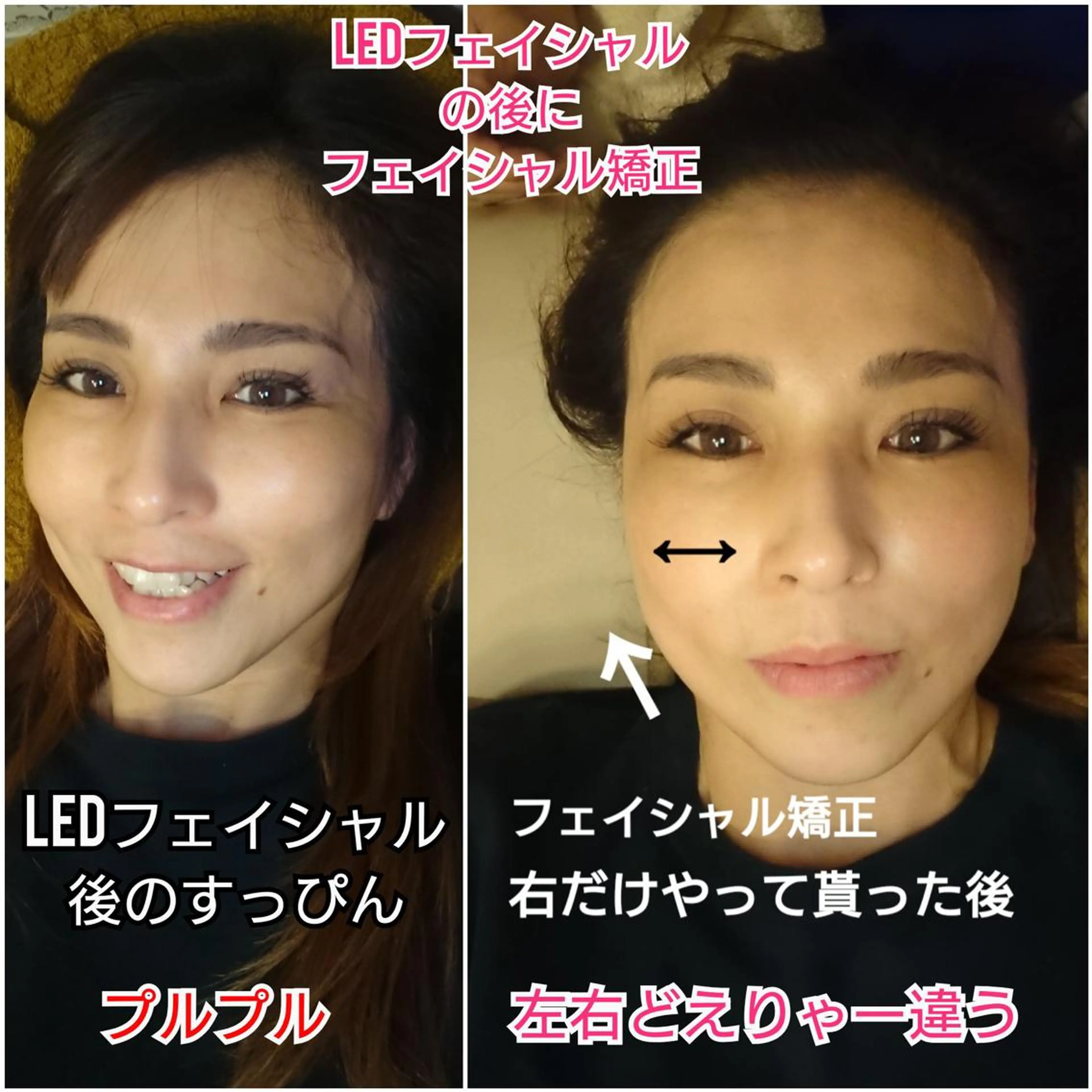 頭蓋骨からアプローチ、浮腫みを流しその場で橋⚪︎環七‼️実感✨美Dical式小顔矯正✨の写真