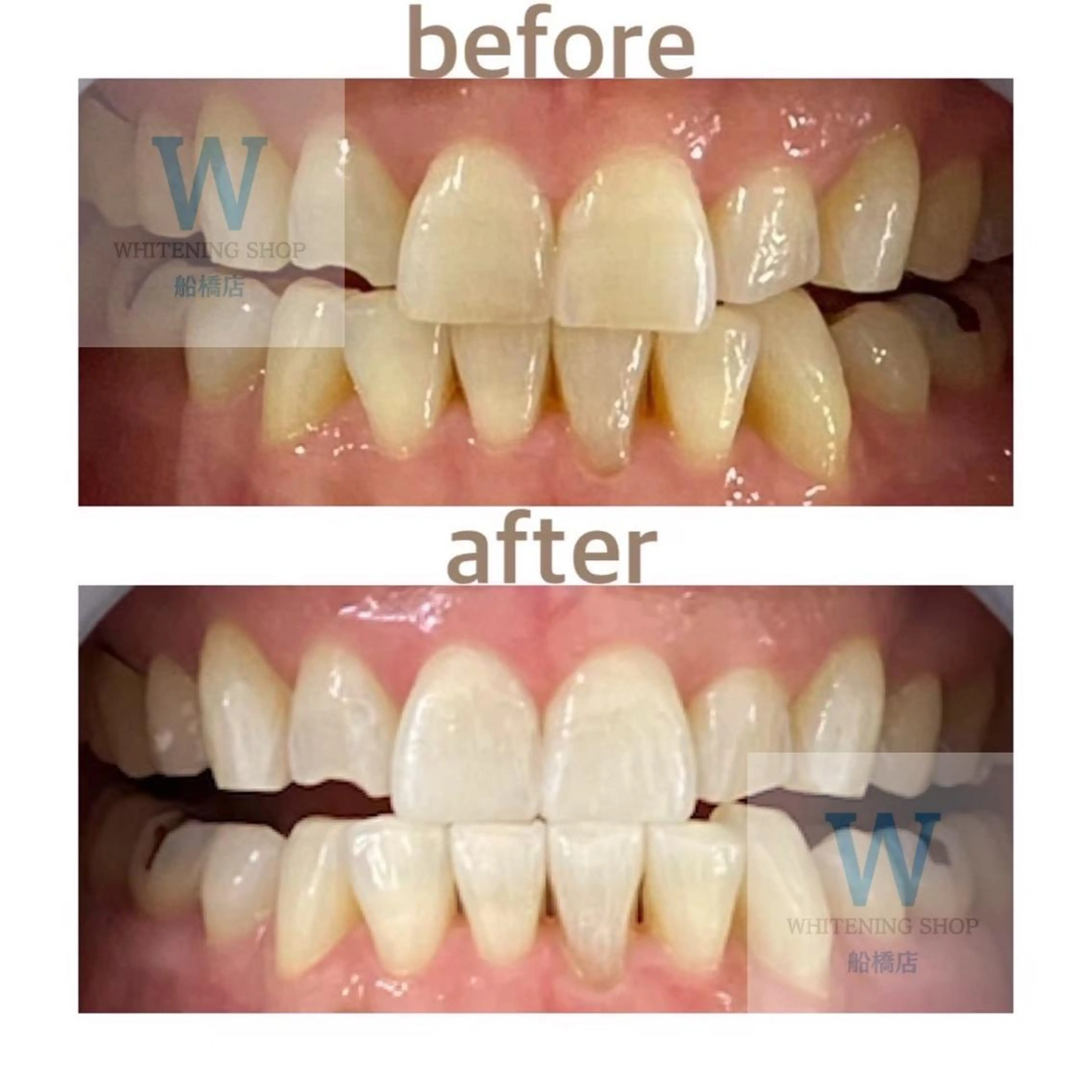 ホワイトニング ショップ船橋２号店のエステ・リラクイメージ