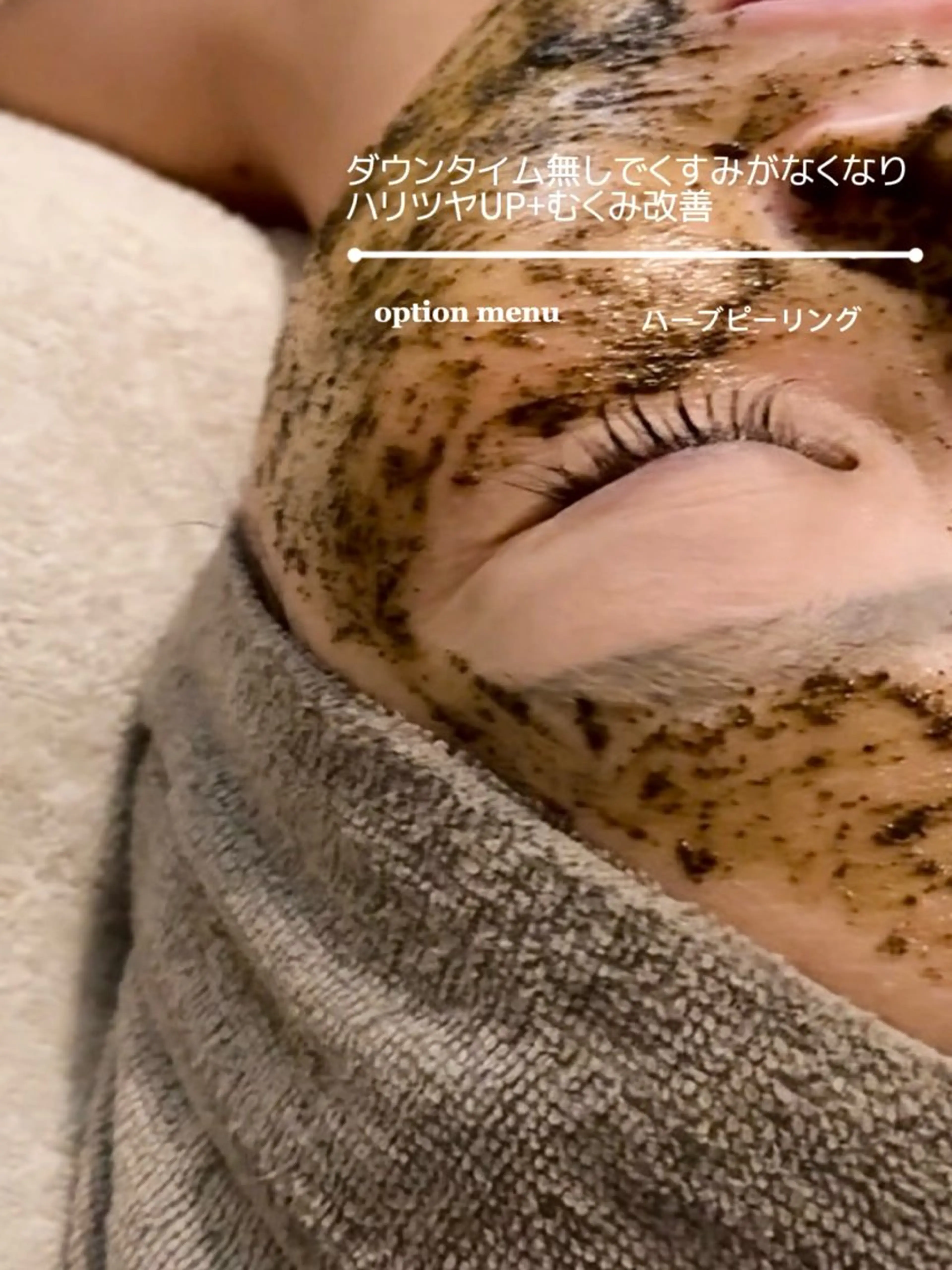 ミニモ限定お試し体験🌿˗ˋˏ 肌質改善ハーブピーリングˎˊ˗🫧の写真