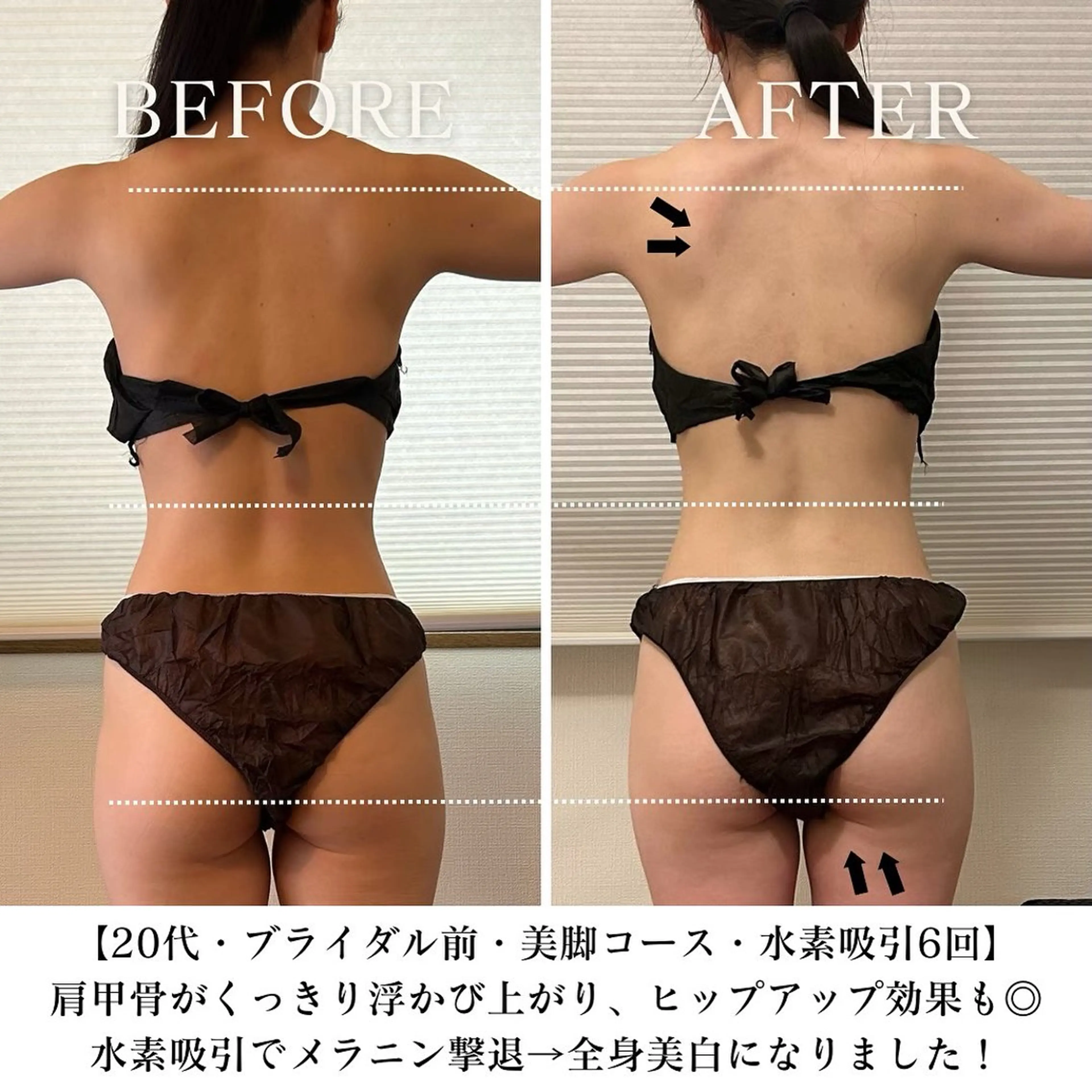【三軒茶屋/下馬】 本格痩身・よもぎ蒸しのエステ・リラクイメージ