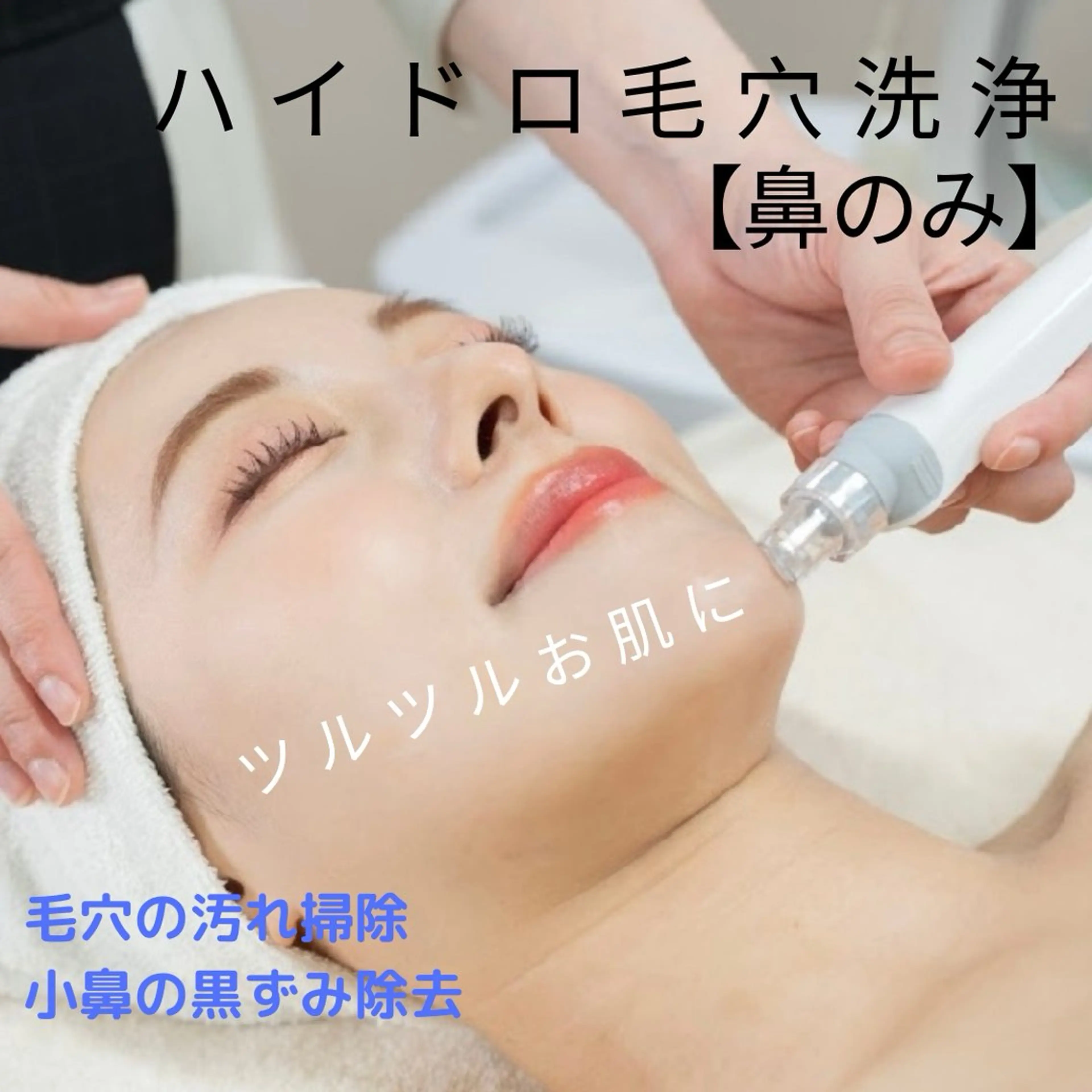 脱苺鼻◎ハイドロ毛穴洗浄（鼻のみ）3900→2900（施術時間およそ45分）の写真