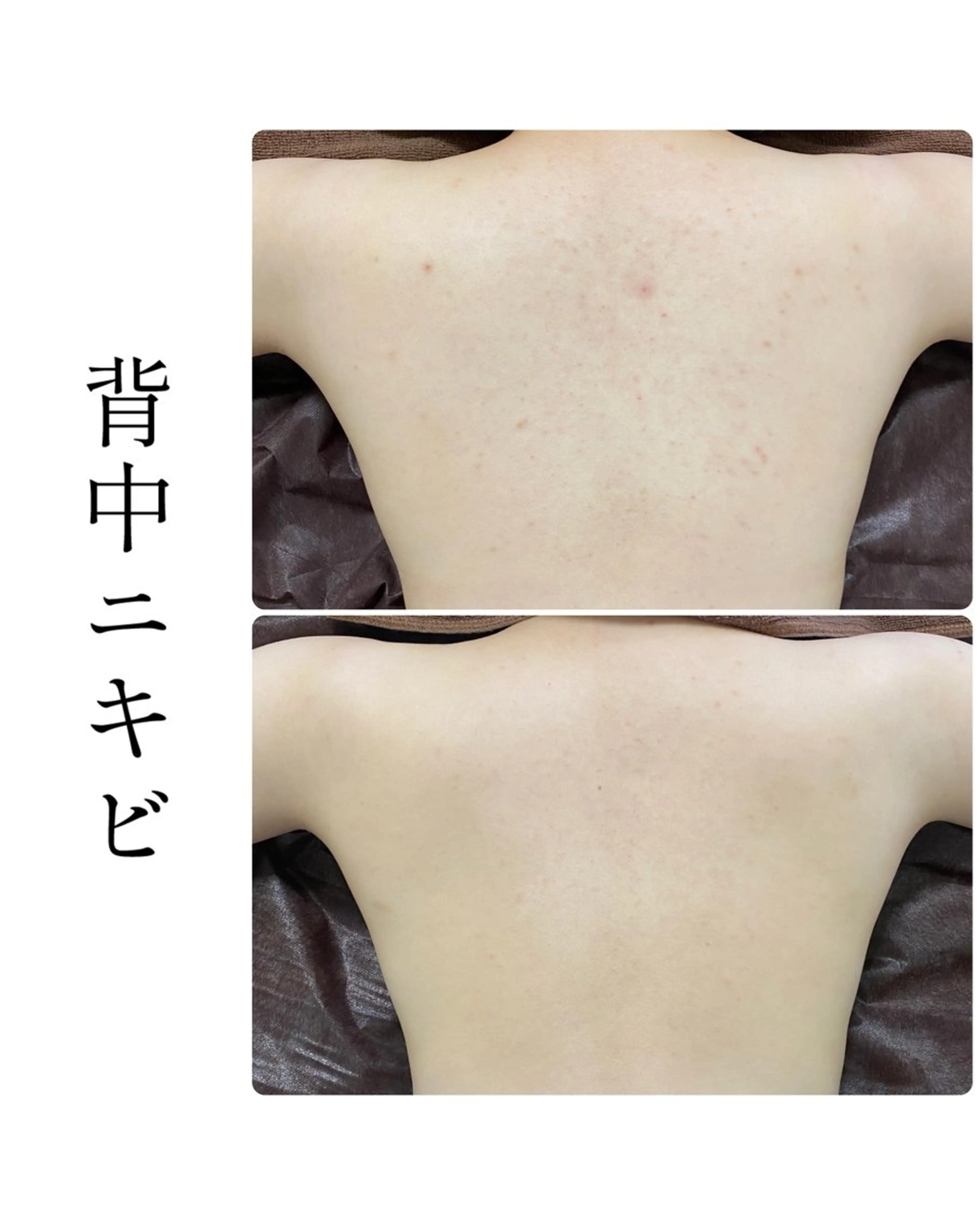 エステ ハーブピーリング専門 BIOEL横浜のエステ・リラクイメージ