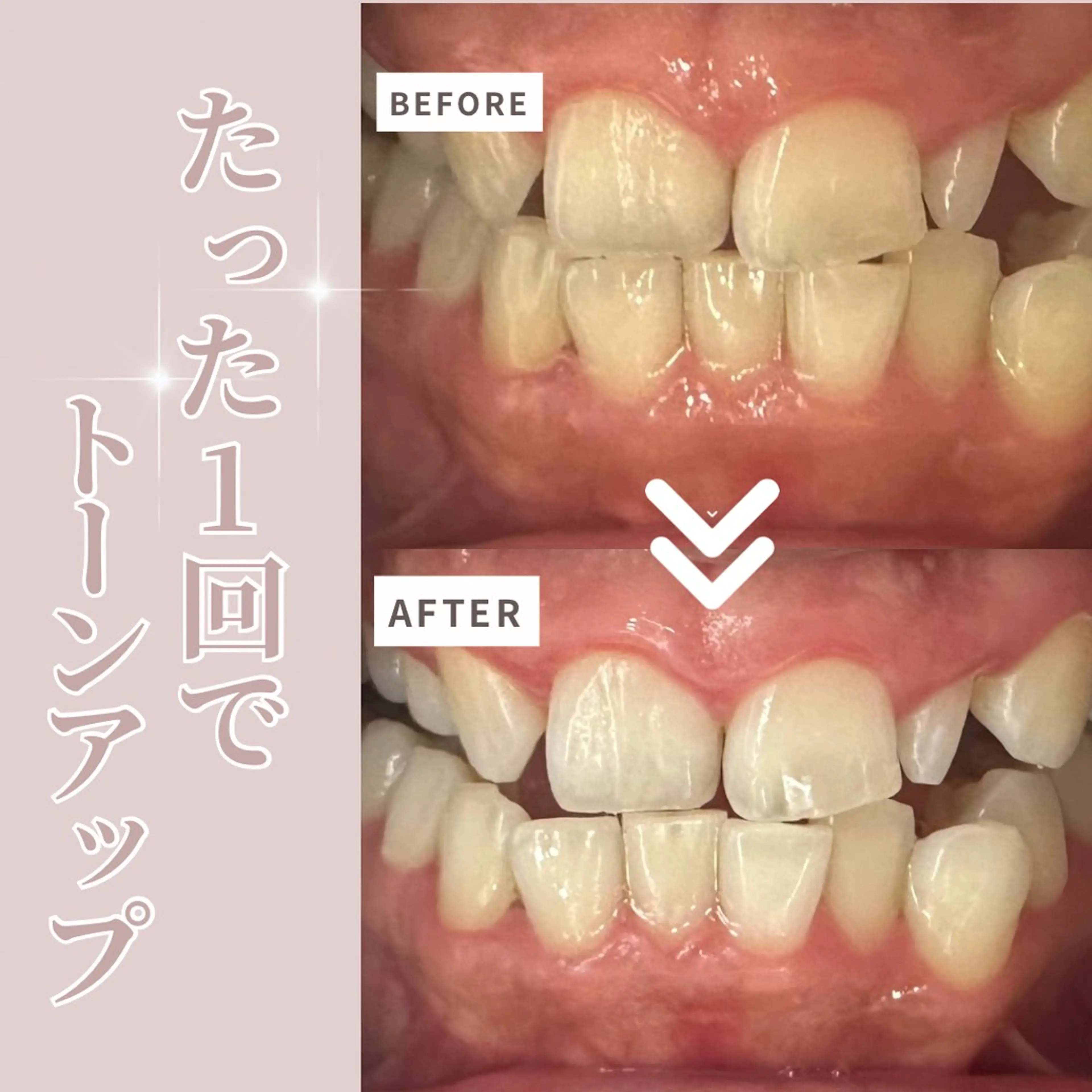 その他 LIBRA自由が丘 ホワイトニングのその他イメージ