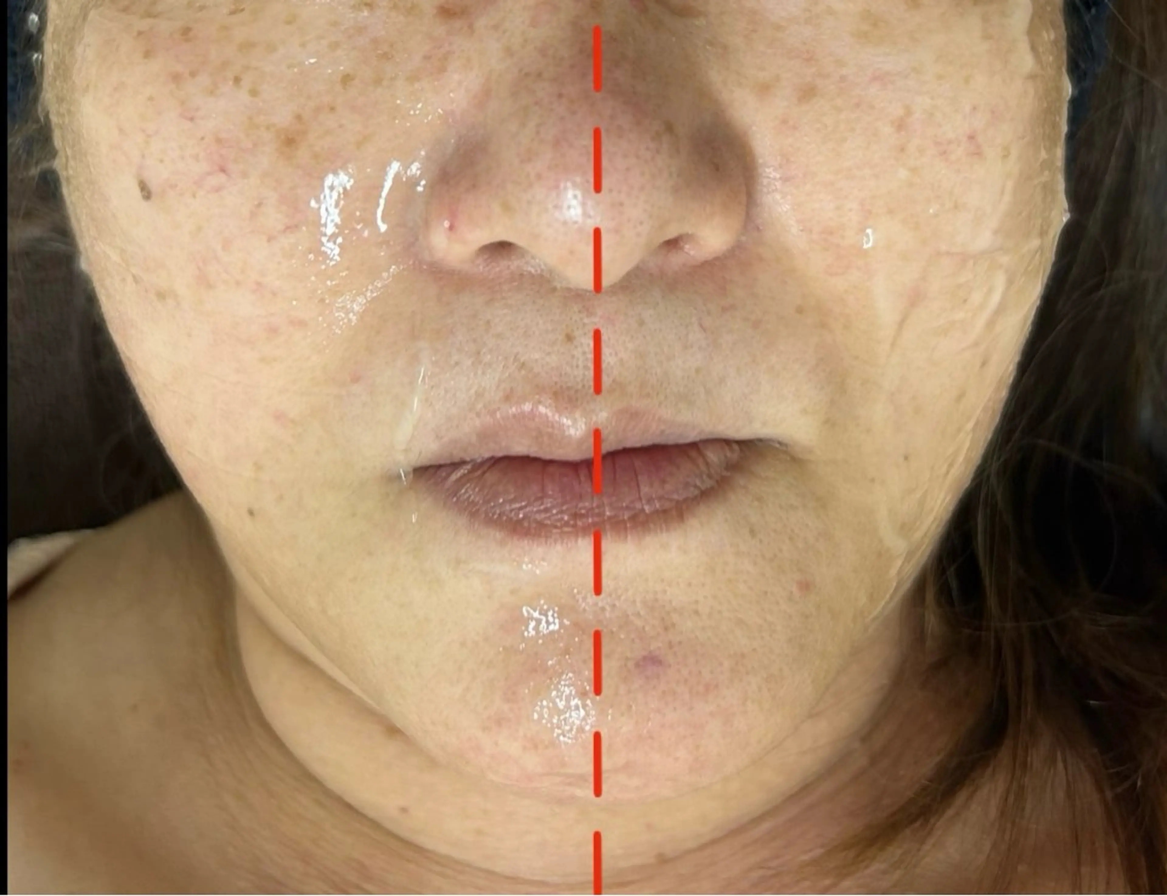 肌質改善 ×ネイルサロンのネイルデザイン