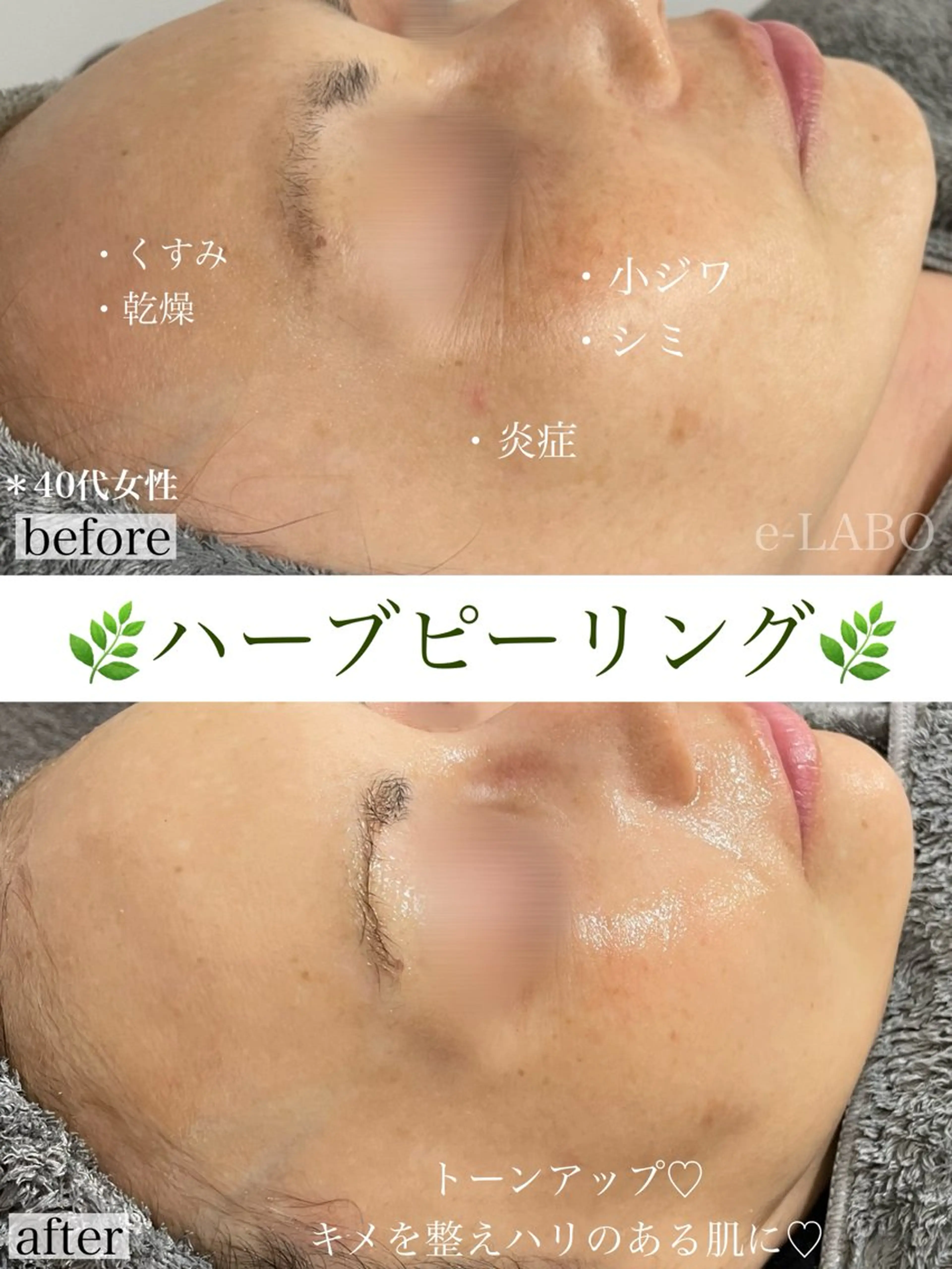 e-LABO こいずみのエステ・リラクイメージ