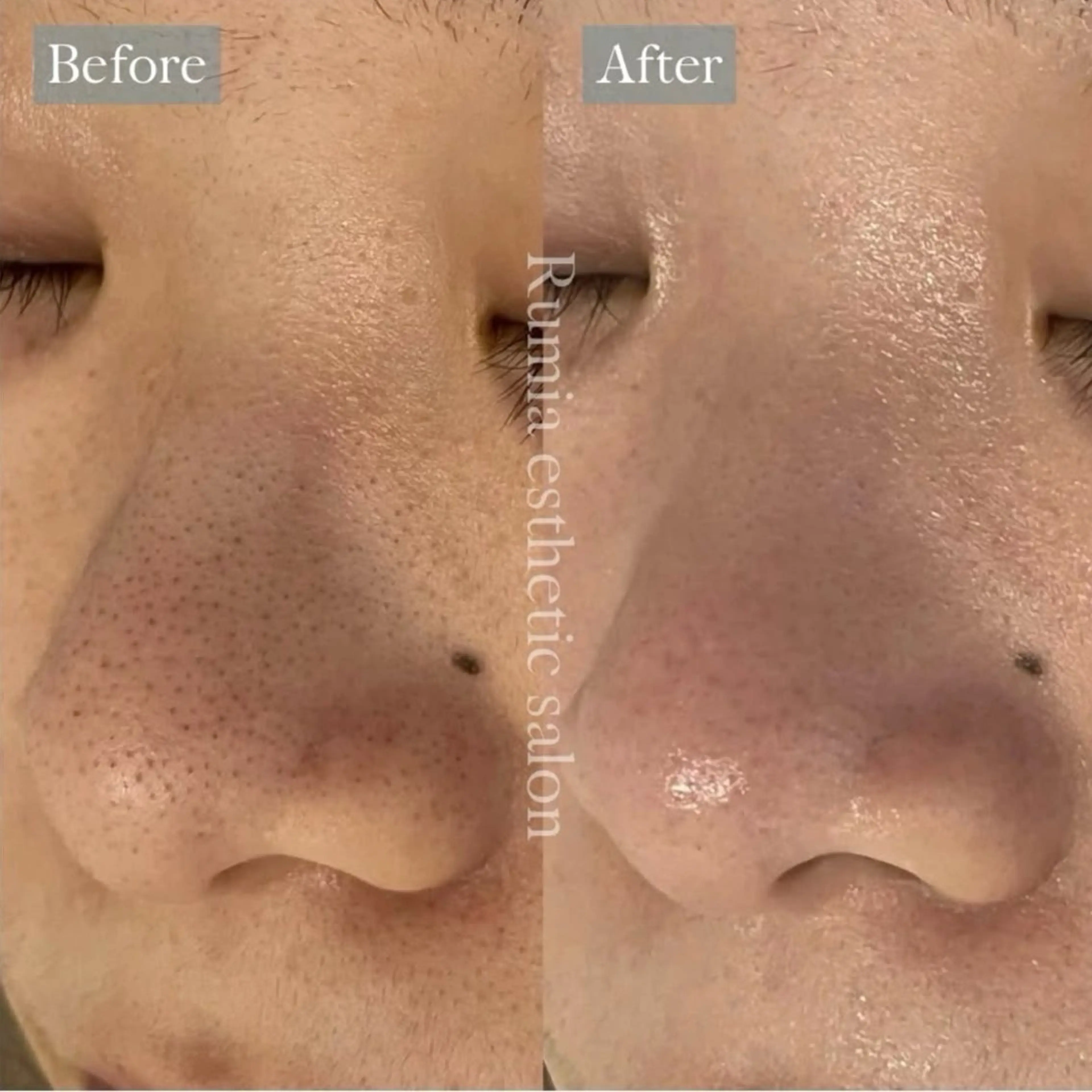 Rumia Salonのエステ・リラクイメージ