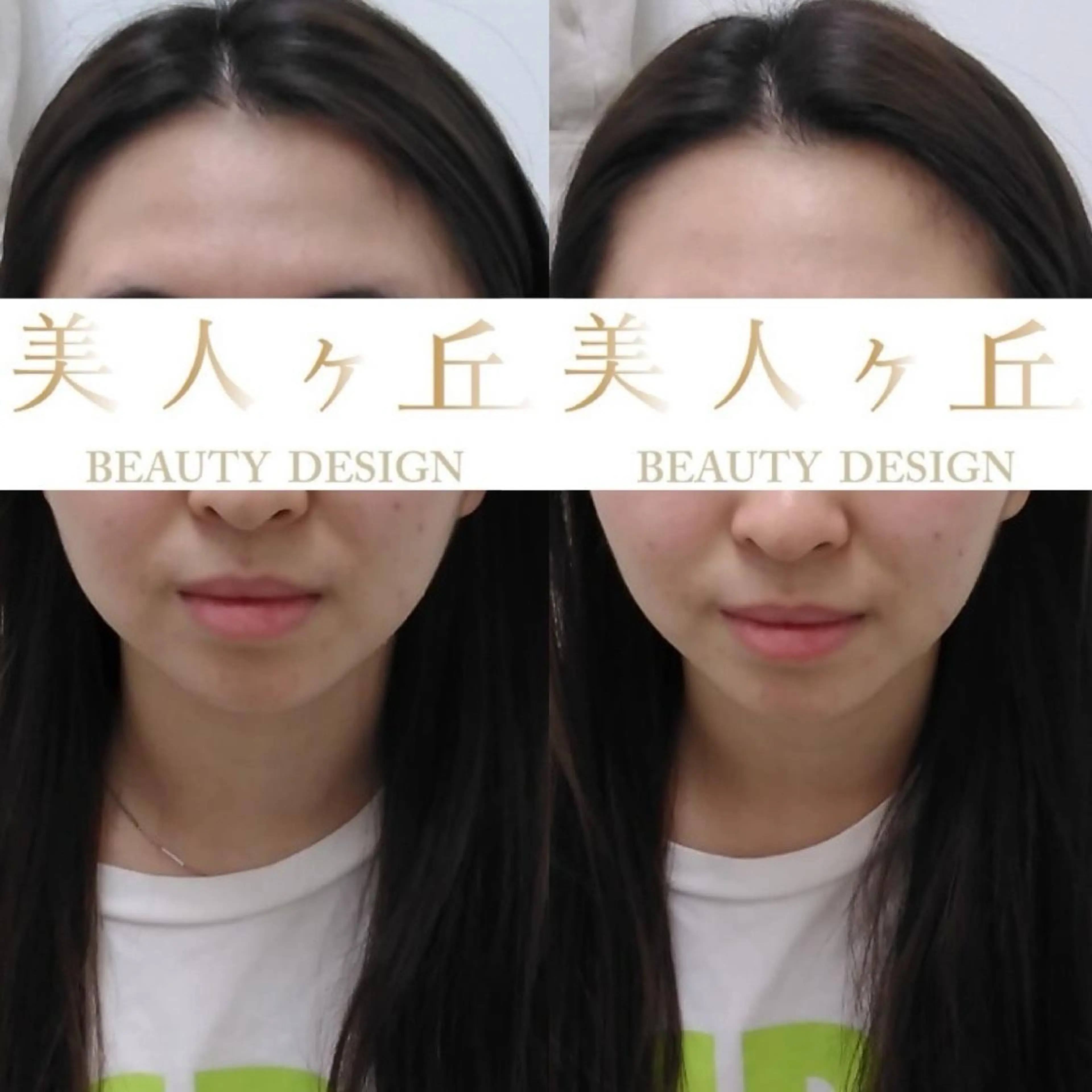 韓国/ヌーディー系 ネイル自由が丘のネイルデザイン