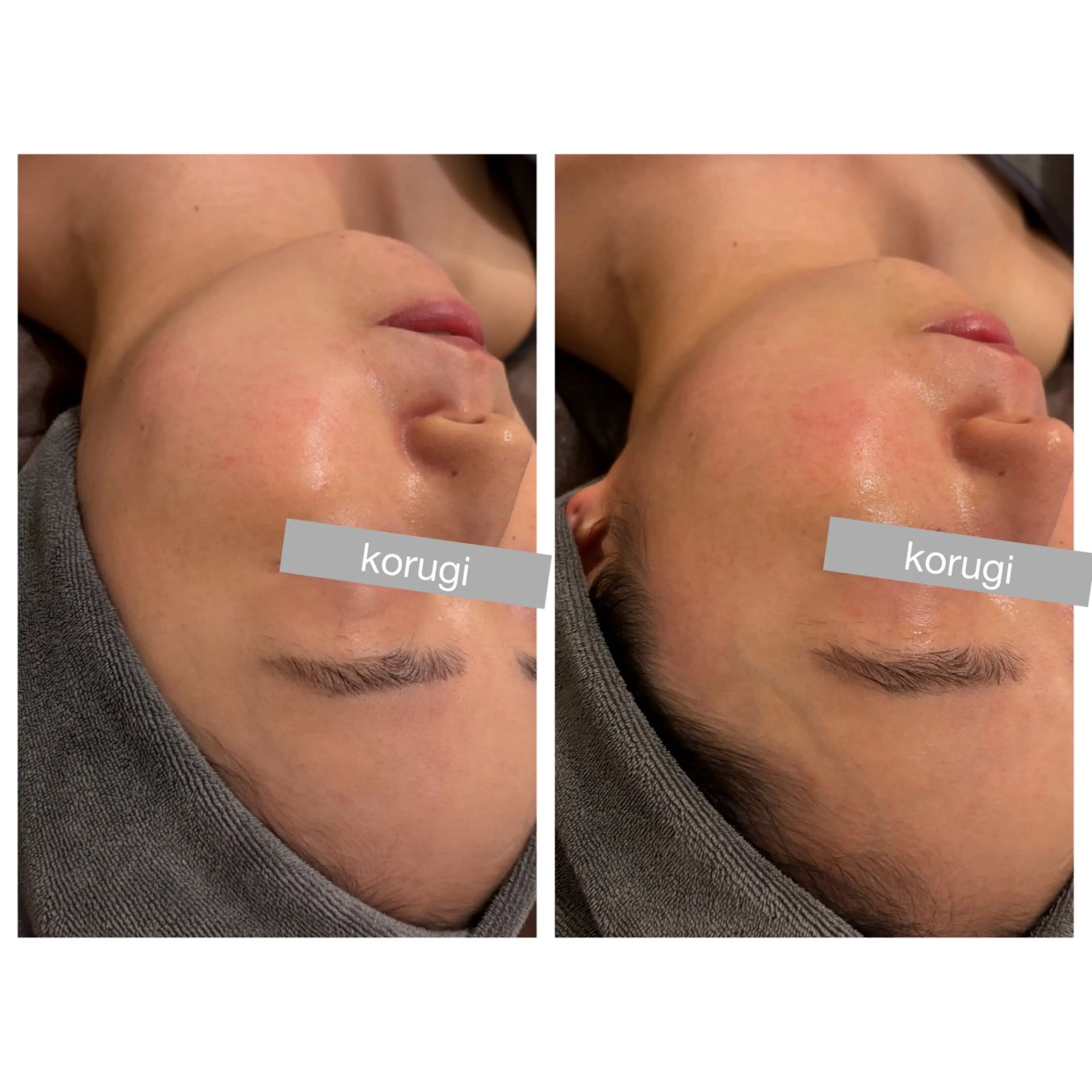 小顔コルギ ☆表参道/外苑前のエステ・リラクイメージ