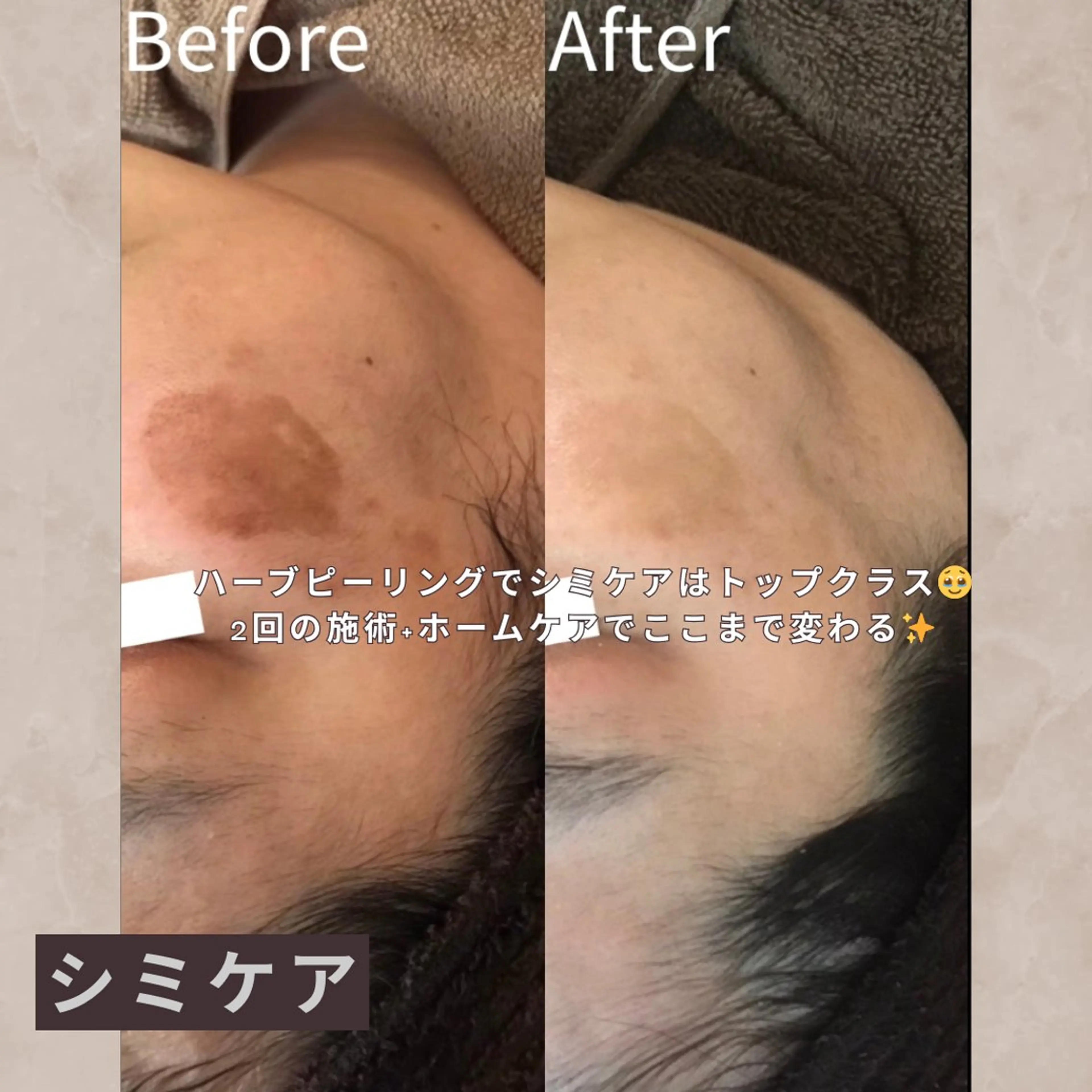 大橋 唯のエステ・リラクイメージ